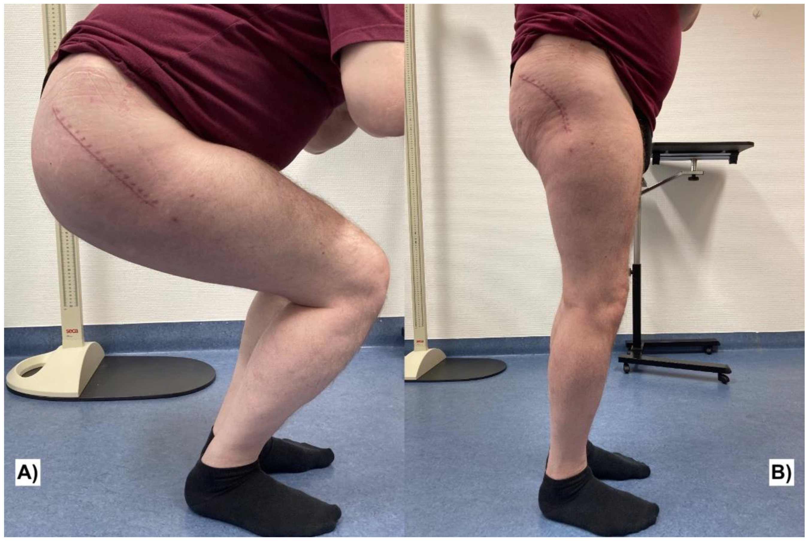 Traumacare 02 00038 g005 550