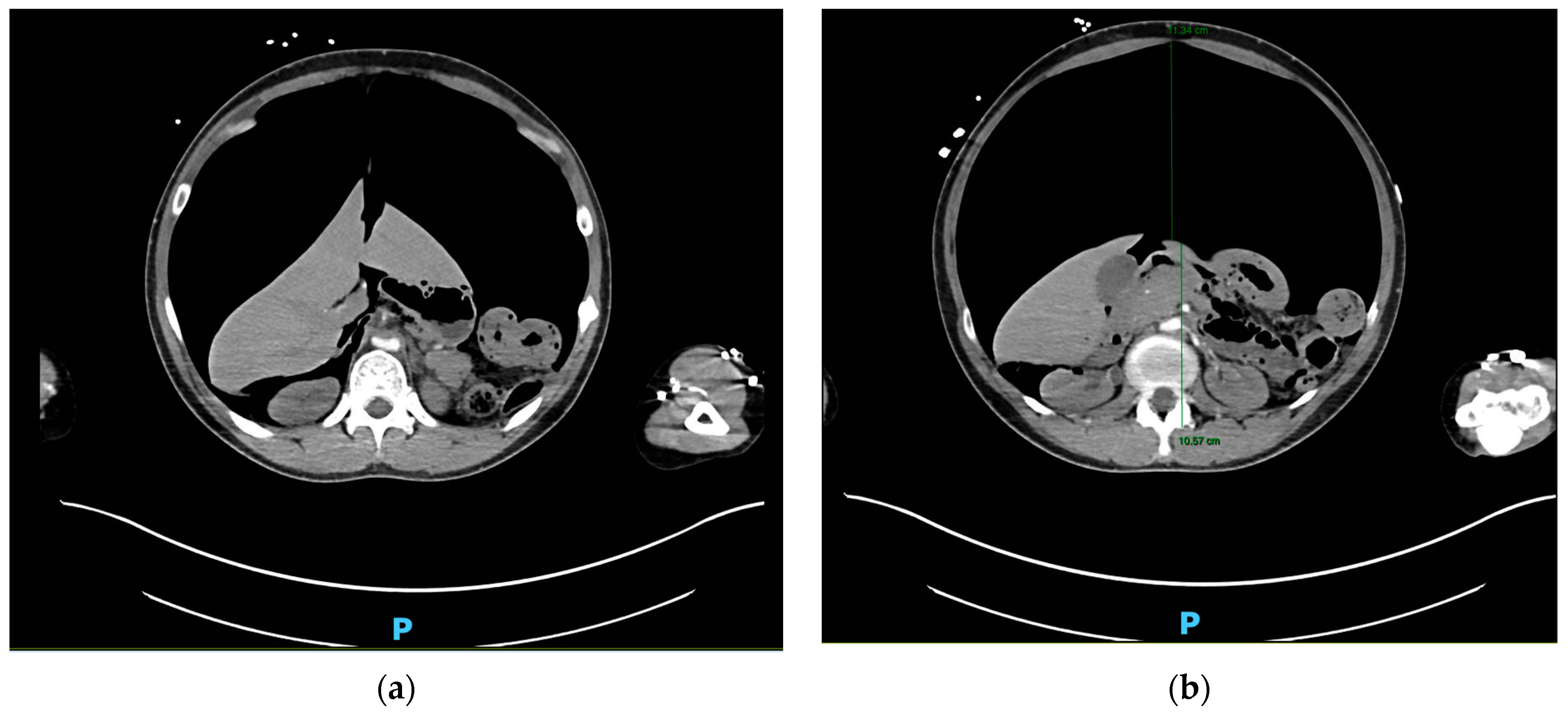 Traumacare 04 00017 g001a