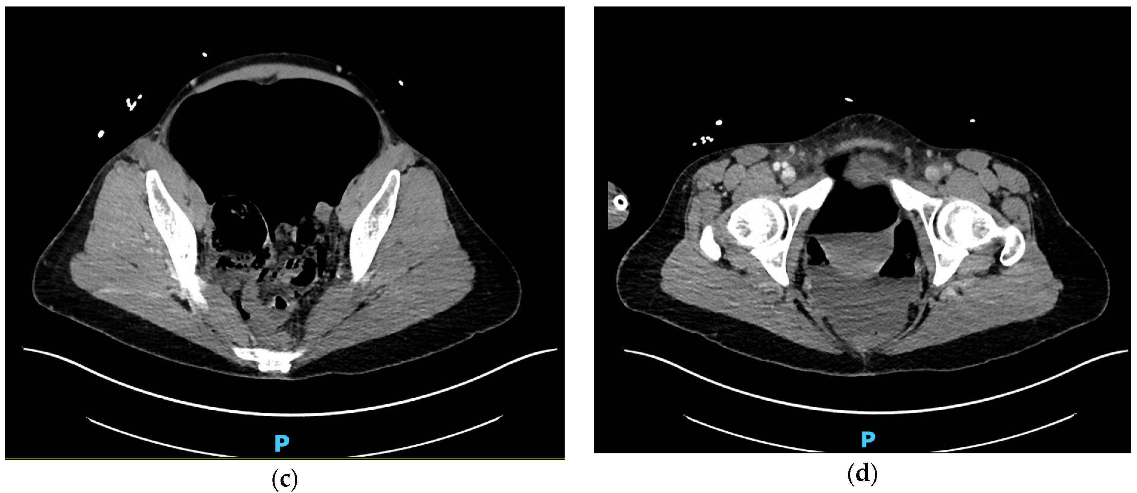 Traumacare 04 00017 g001b