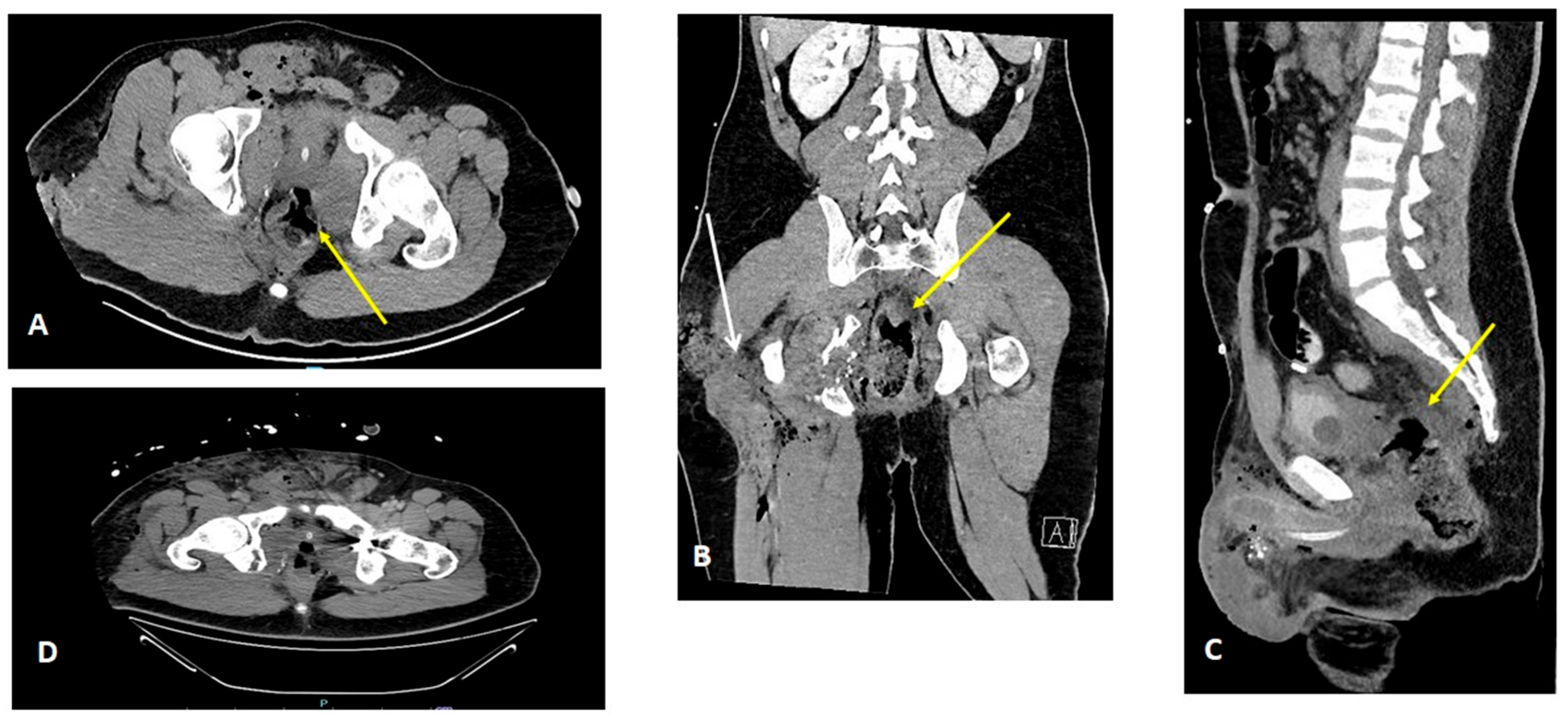 Traumacare 05 00012 g001