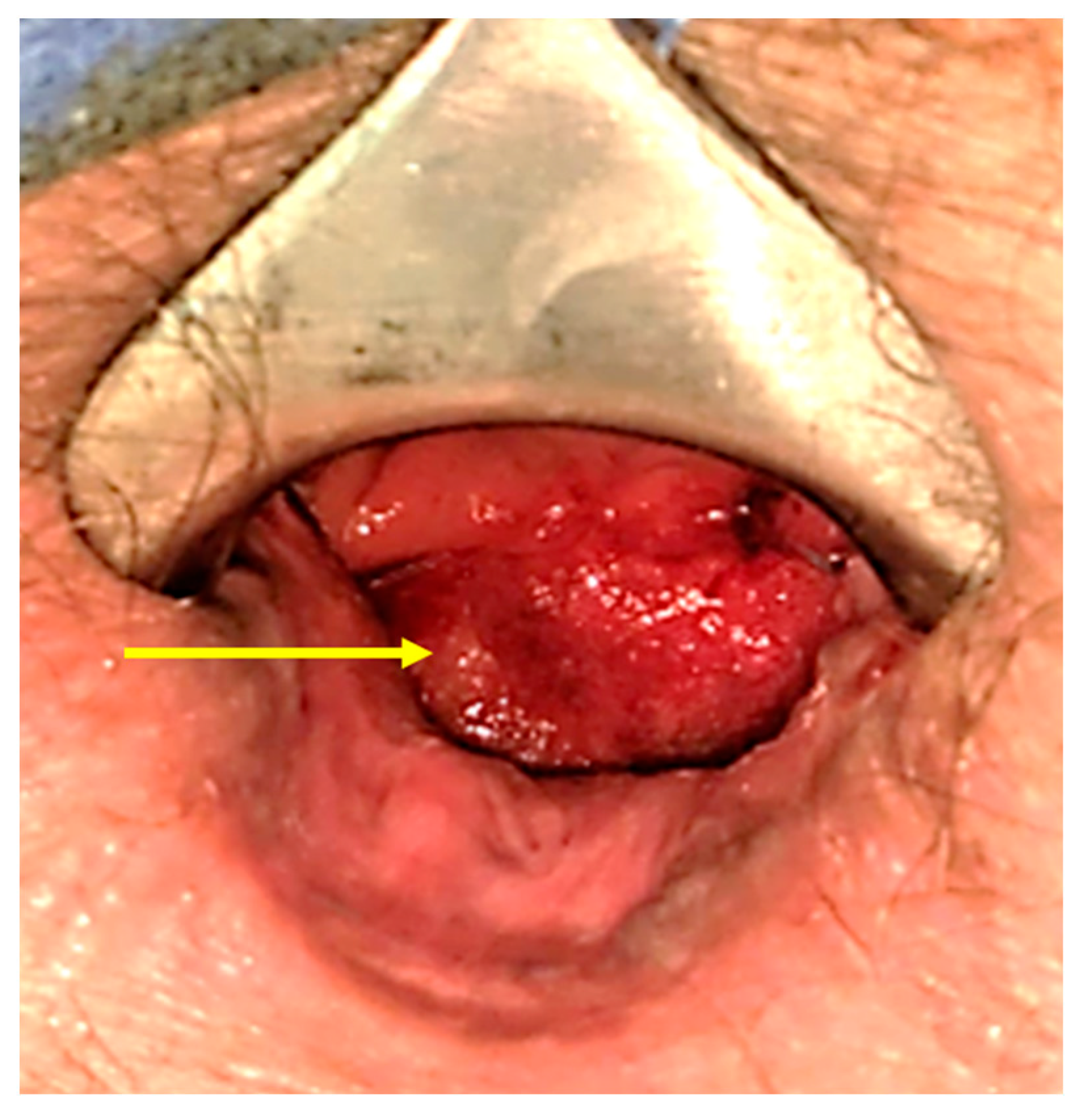 Traumacare 05 00012 g003