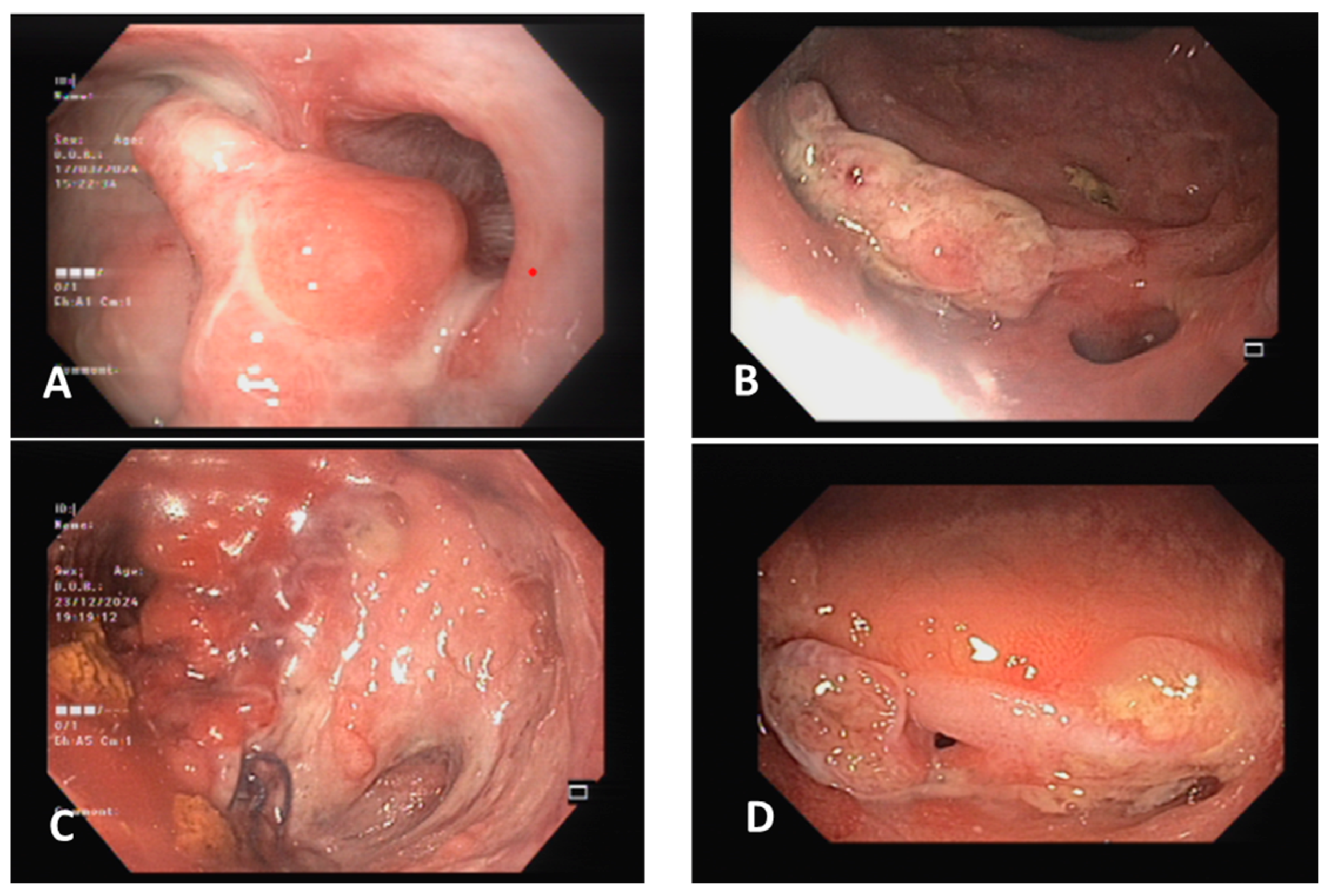 Traumacare 05 00012 g004