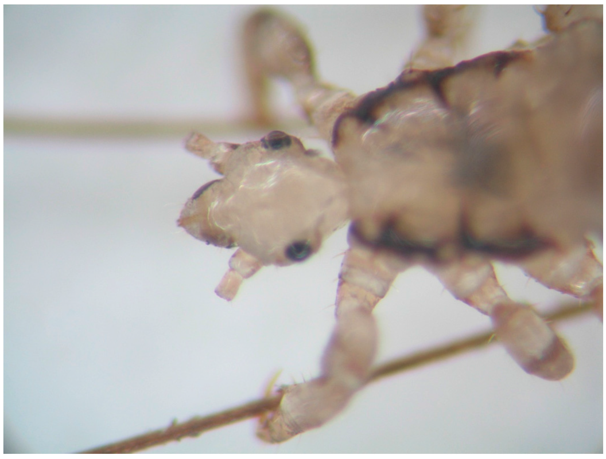 TropicalMed Free FullText Orientation of Head Lice on Human Hosts