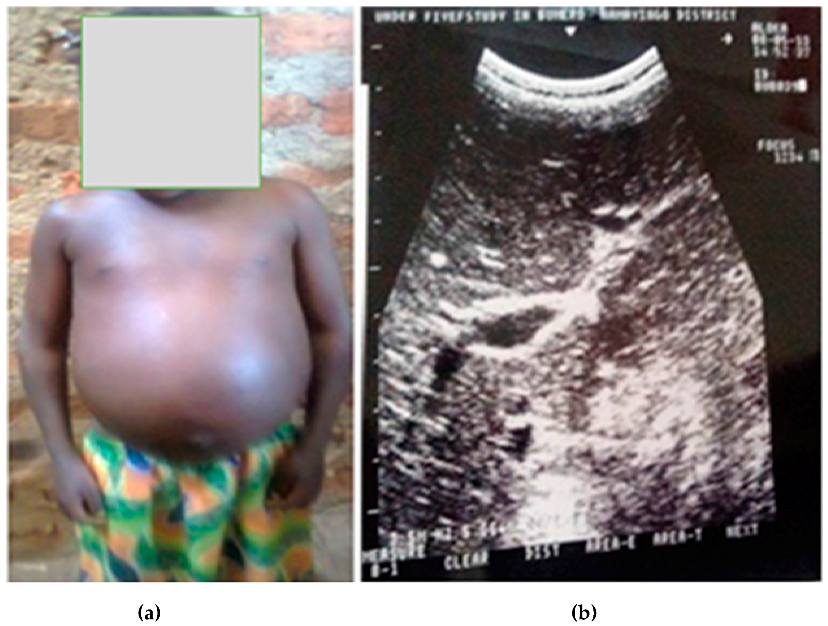 Tropicalmed 02 00058 g002