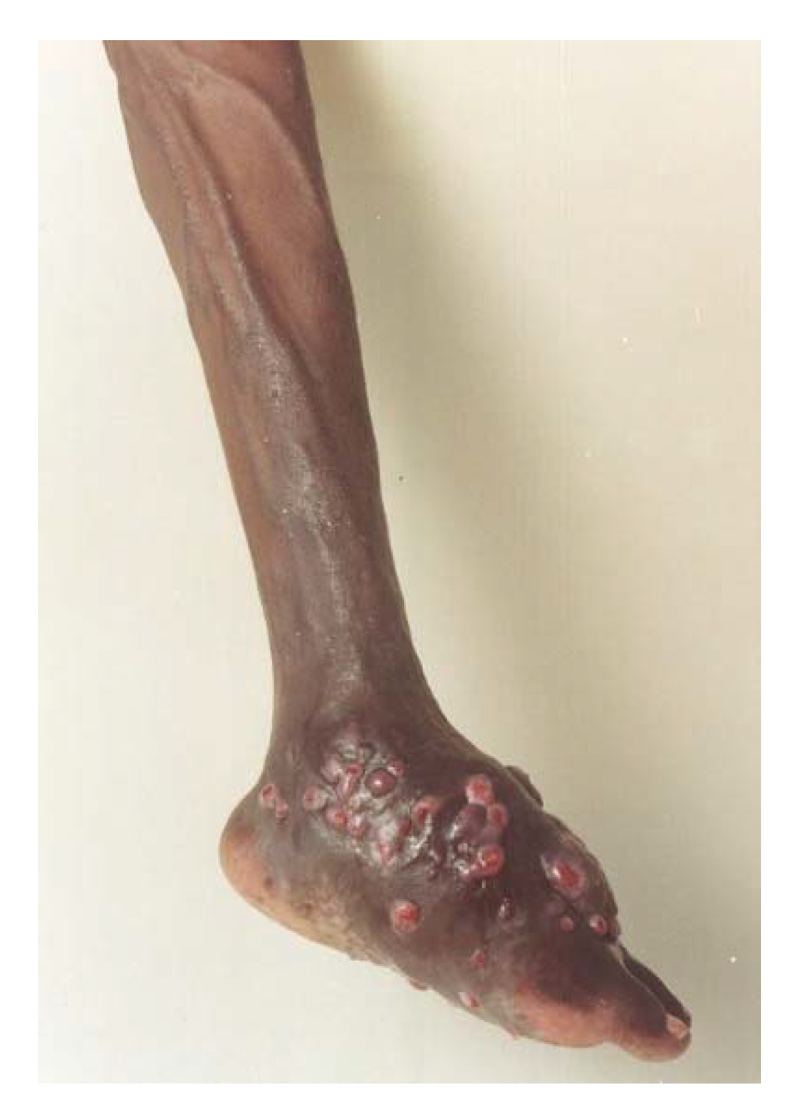 Tropicalmed 03 00097 g007