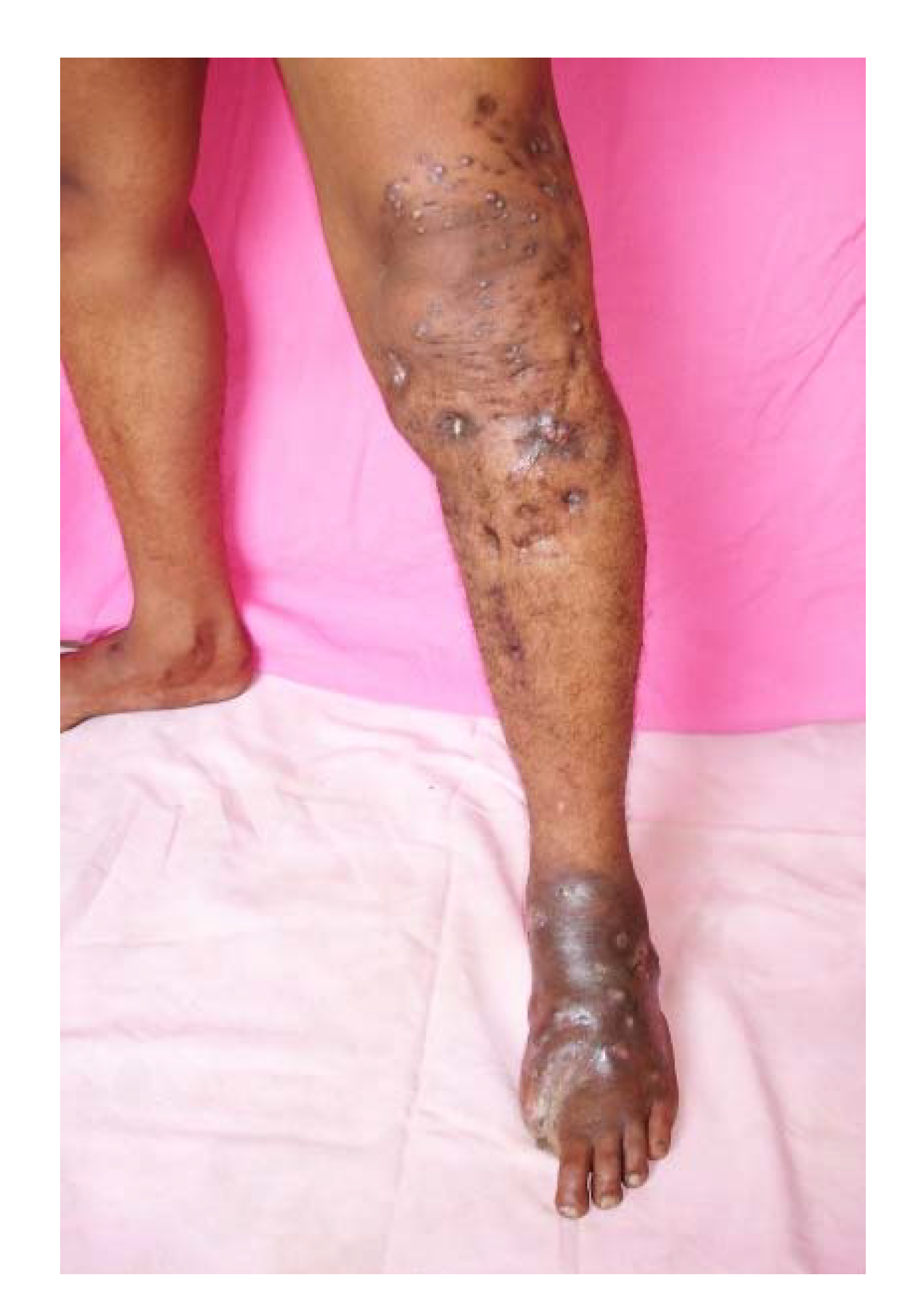 Tropicalmed 03 00097 g011