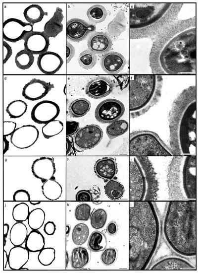 Image: India Ink Stain (Cryptococcus neoformans) - Merck Manuals  Professional Edition