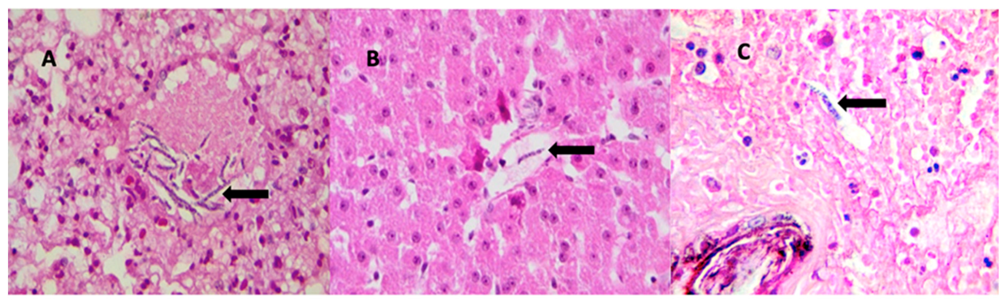 Tropicalmed 04 00077 g003