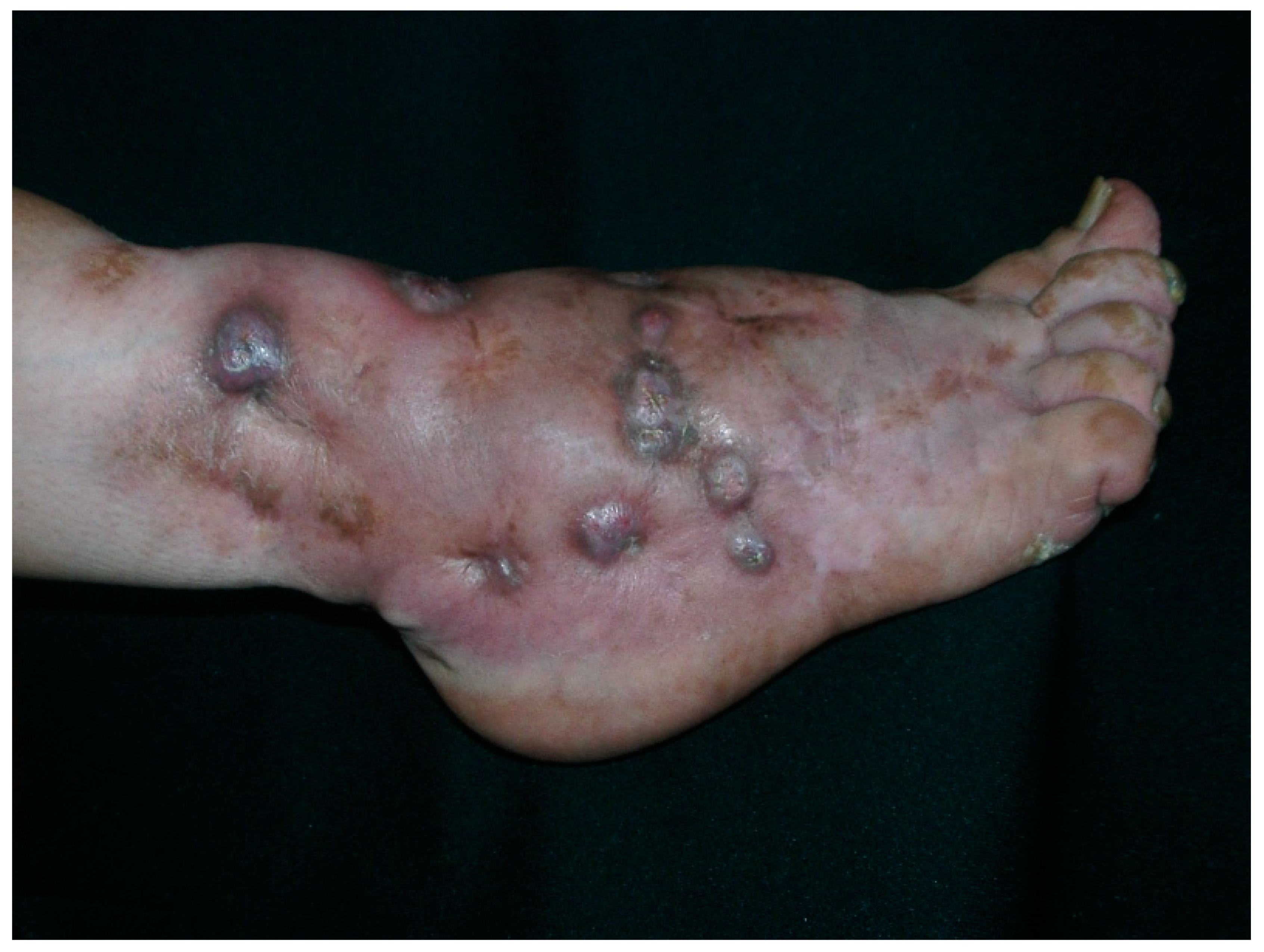 Tropicalmed 04 00081 g001