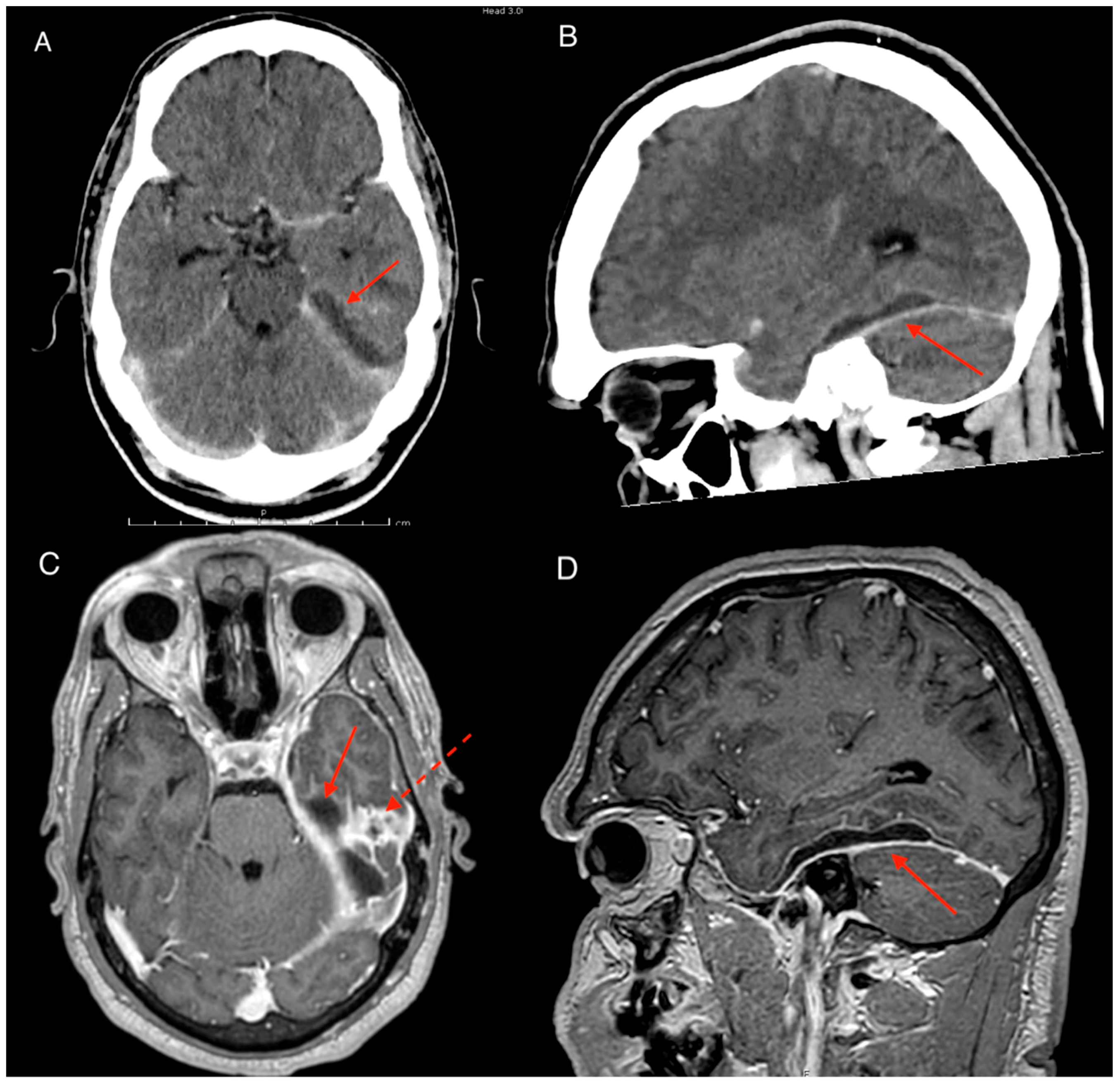 Tropicalmed 04 00120 g001 550