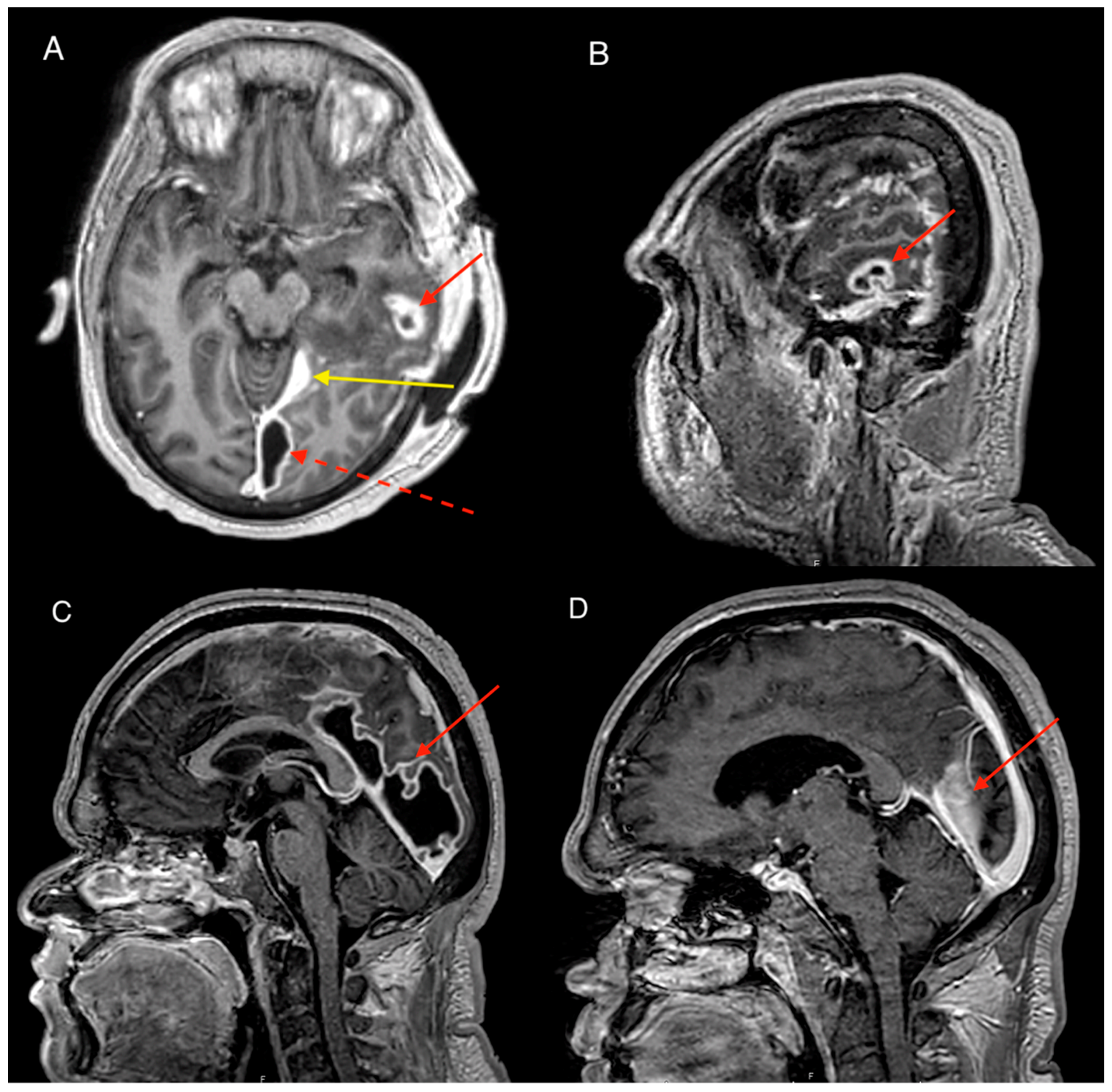Tropicalmed 04 00120 g003 550