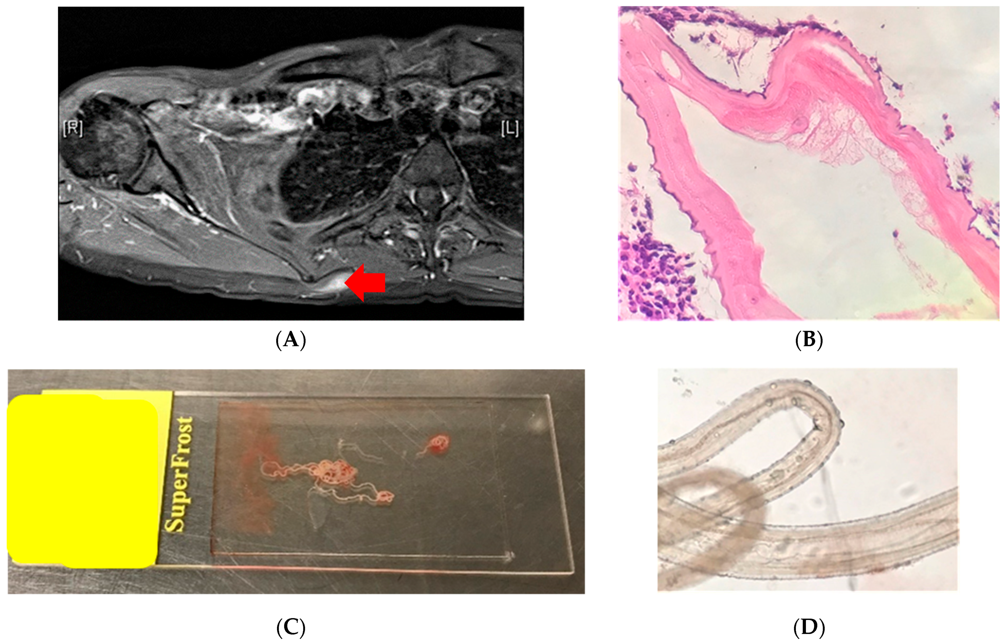 Tropicalmed 05 00008 g003 Tropicalmed 05 00008 g003