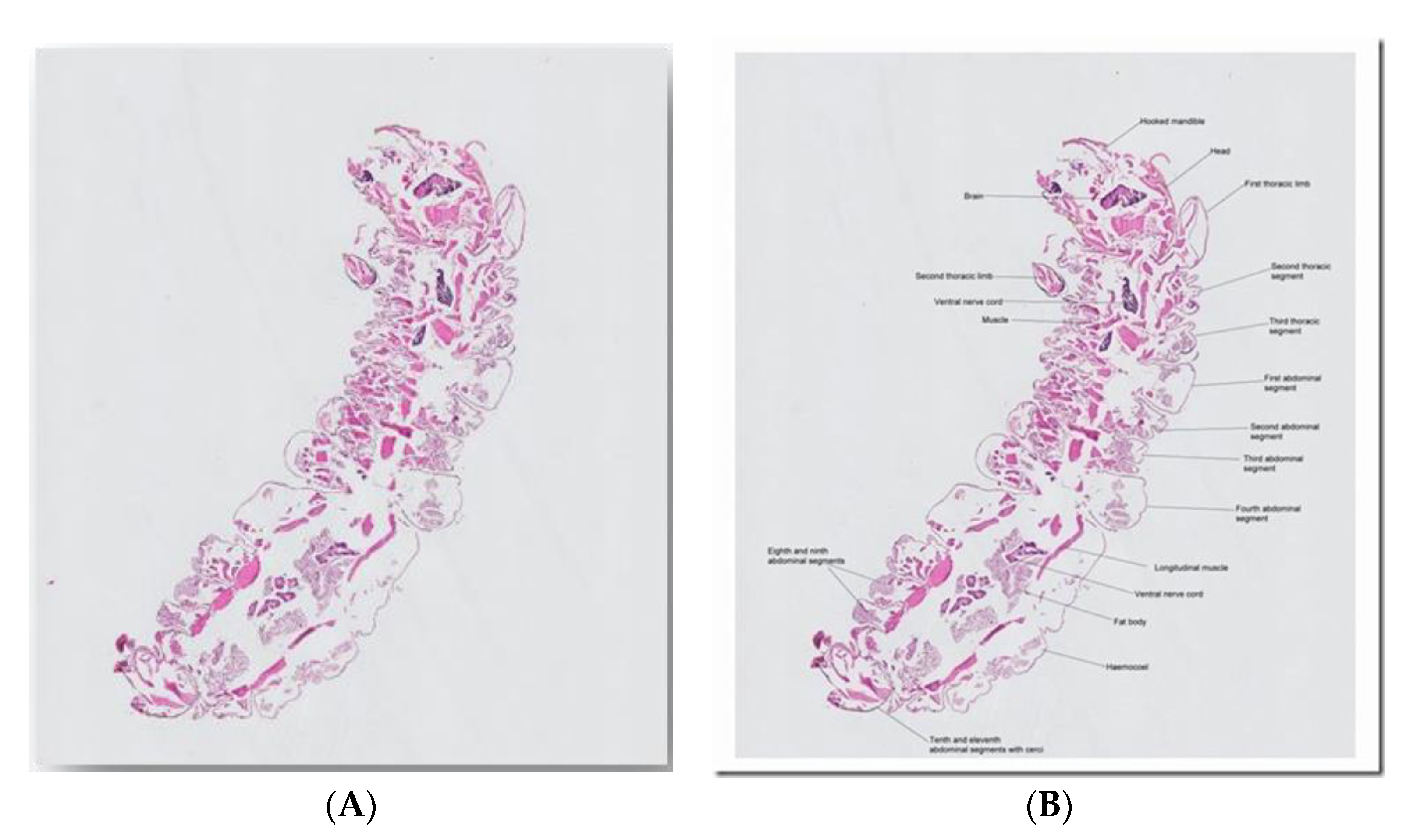 Tropicalmed 05 00008 g004 Tropicalmed 05 00008 g004