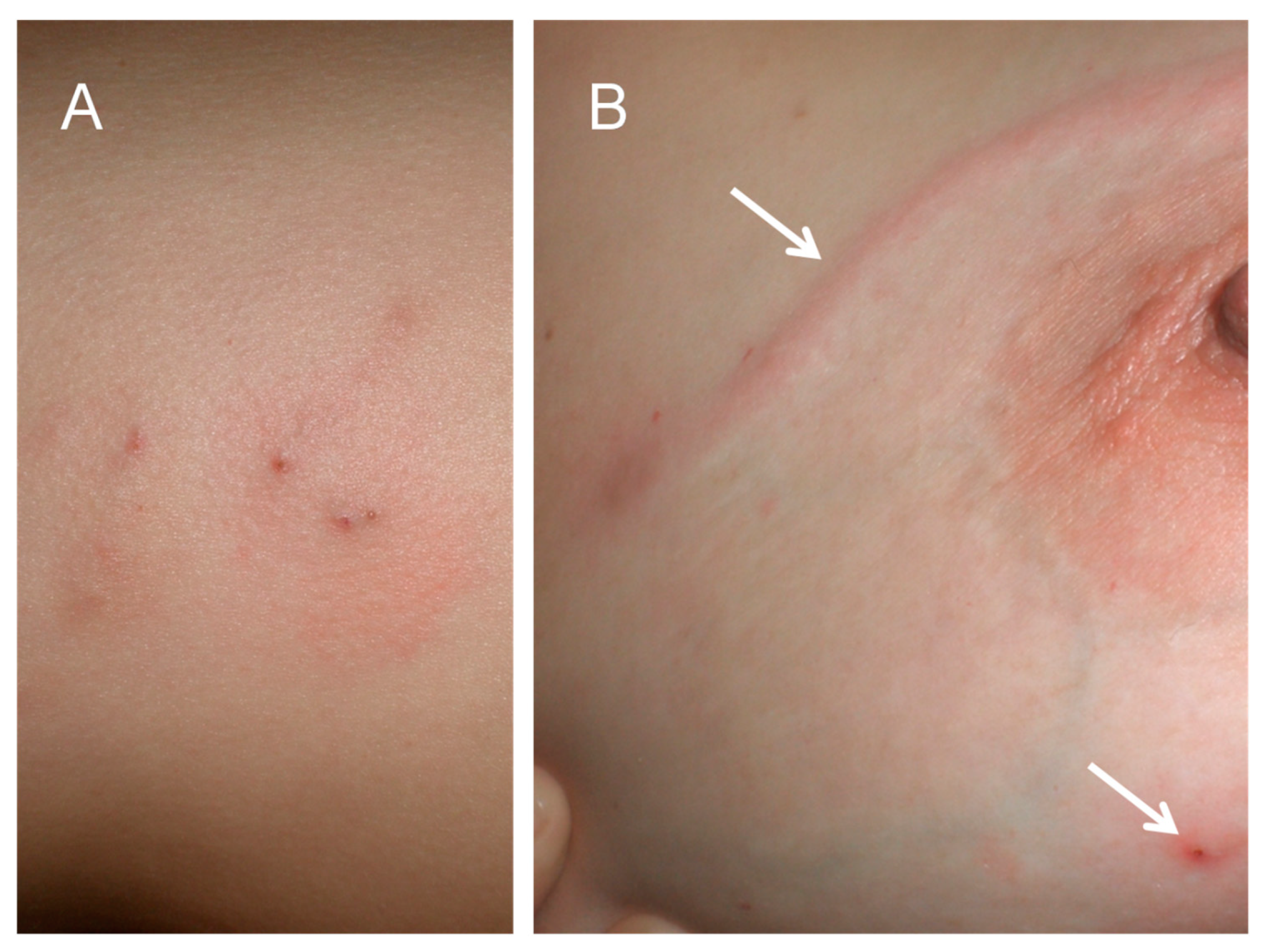 Tropicalmed 05 00039 g003