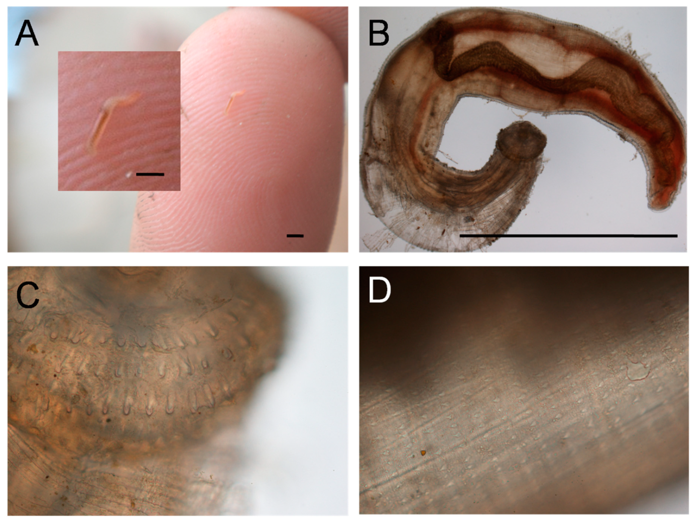 Tropicalmed Free Full Text Gnathostomiasis Acquired By Visitors To The Okavango Delta Botswana Html