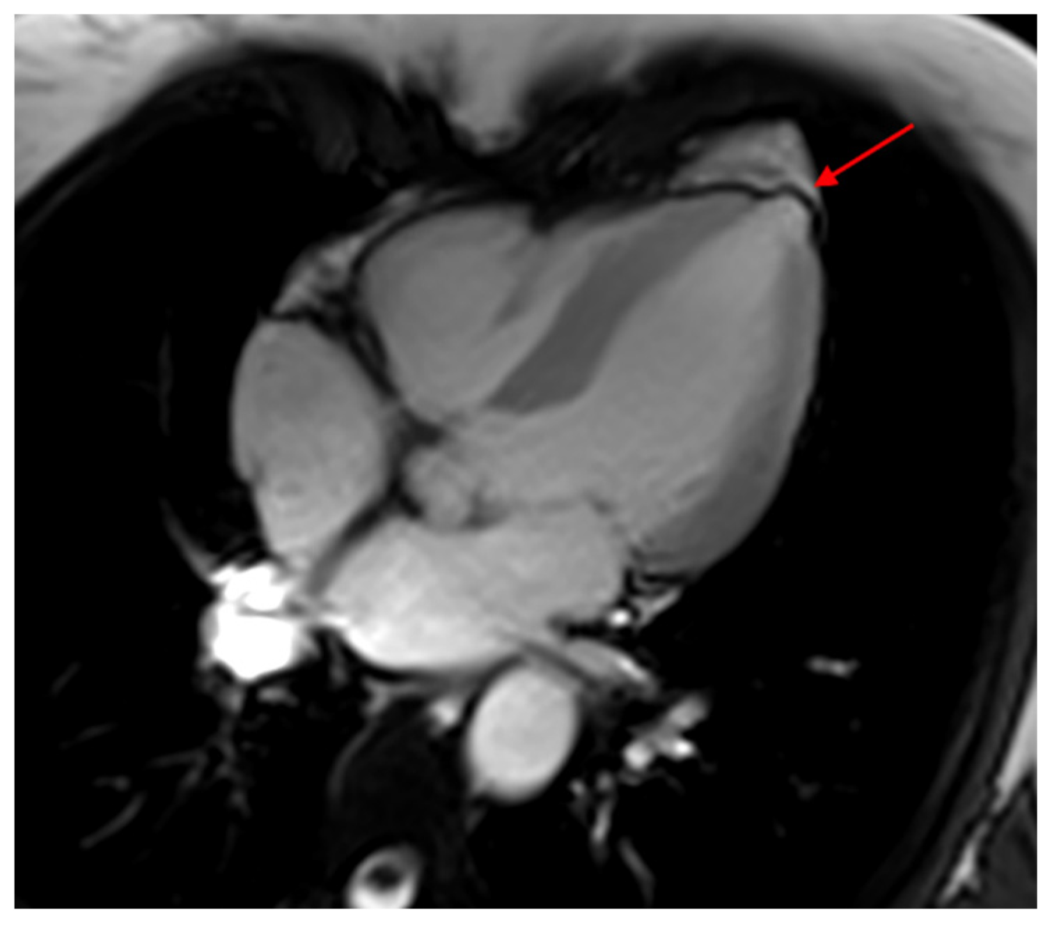 Tropicalmed 05 00074 g002