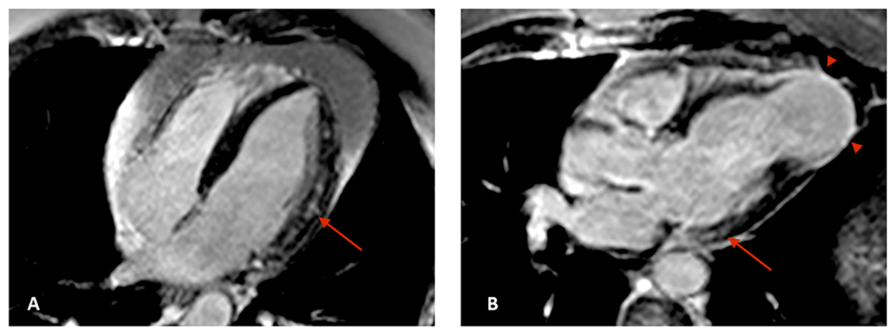 Tropicalmed 05 00074 g003