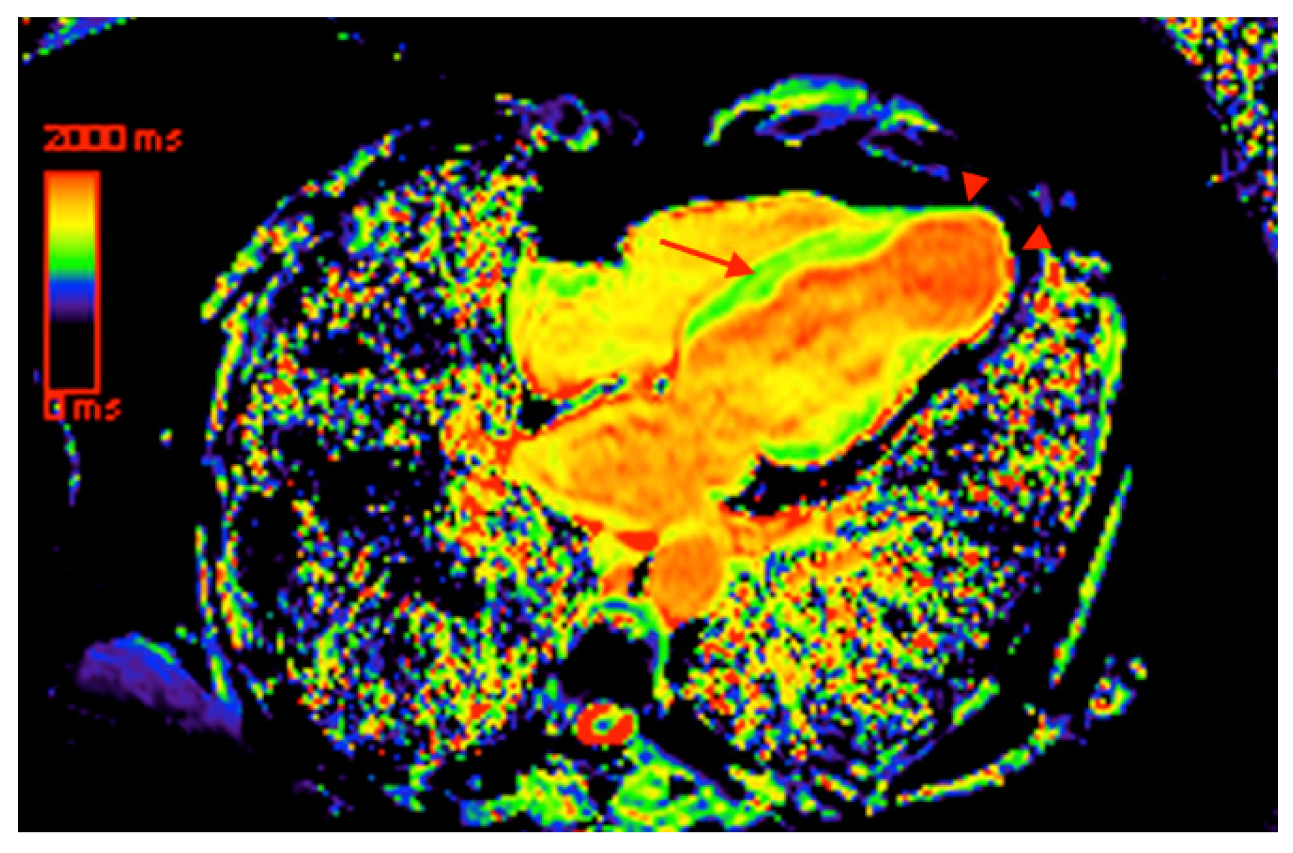 Tropicalmed 05 00074 g004