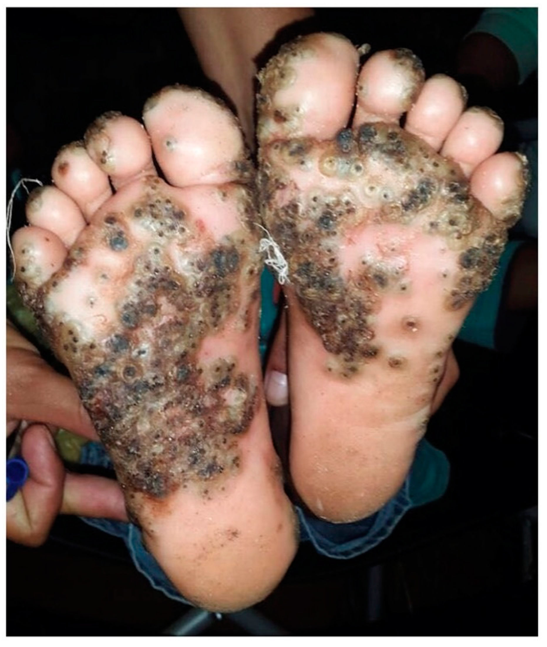 Tropicalmed 05 00122 g001