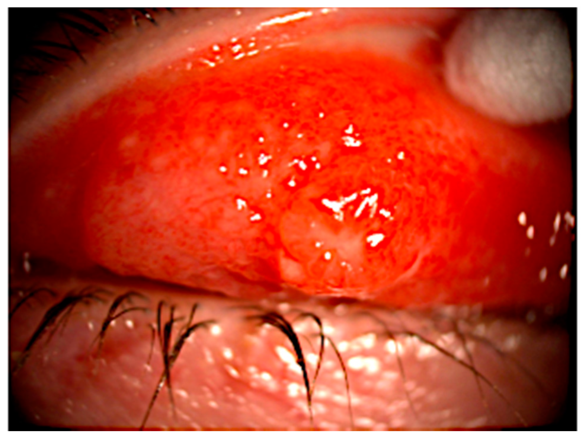 Tropicalmed 05 00126 g002 Tropicalmed 05 00126 g002