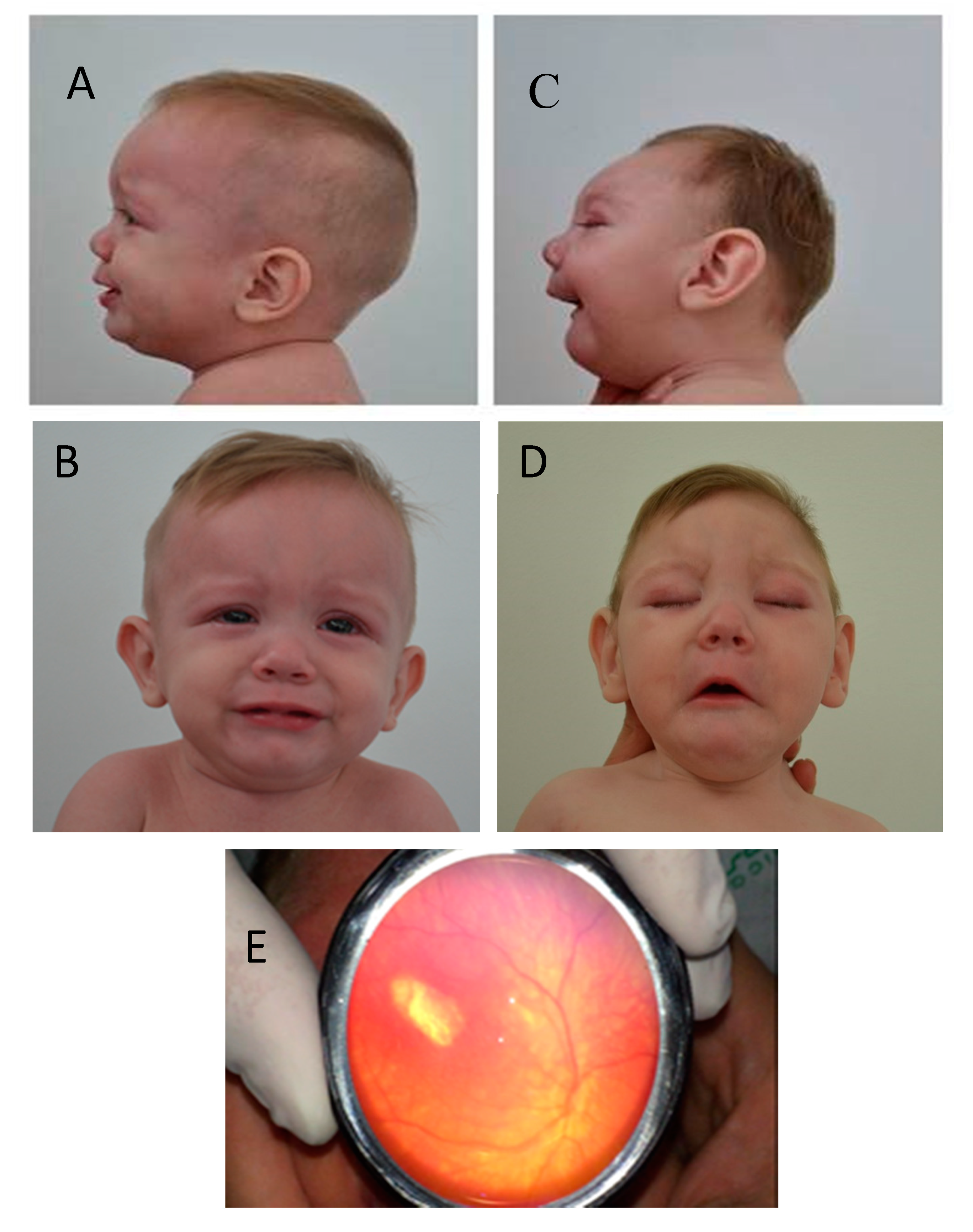 Tropicalmed 05 00188 g003 Tropicalmed 05 00188 g003