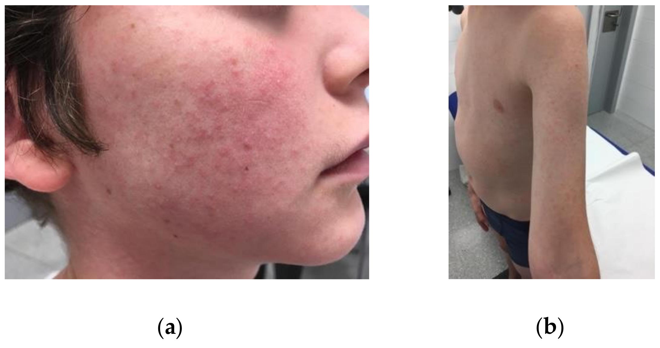 Tropicalmed 06 00003 g001