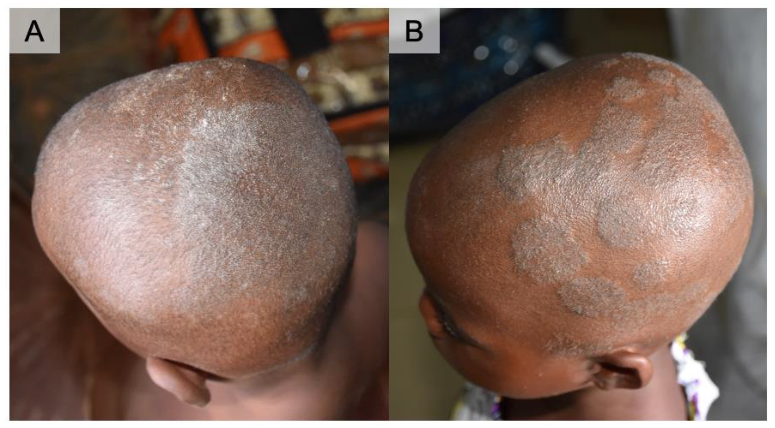 Tropicalmed 06 00009 g001