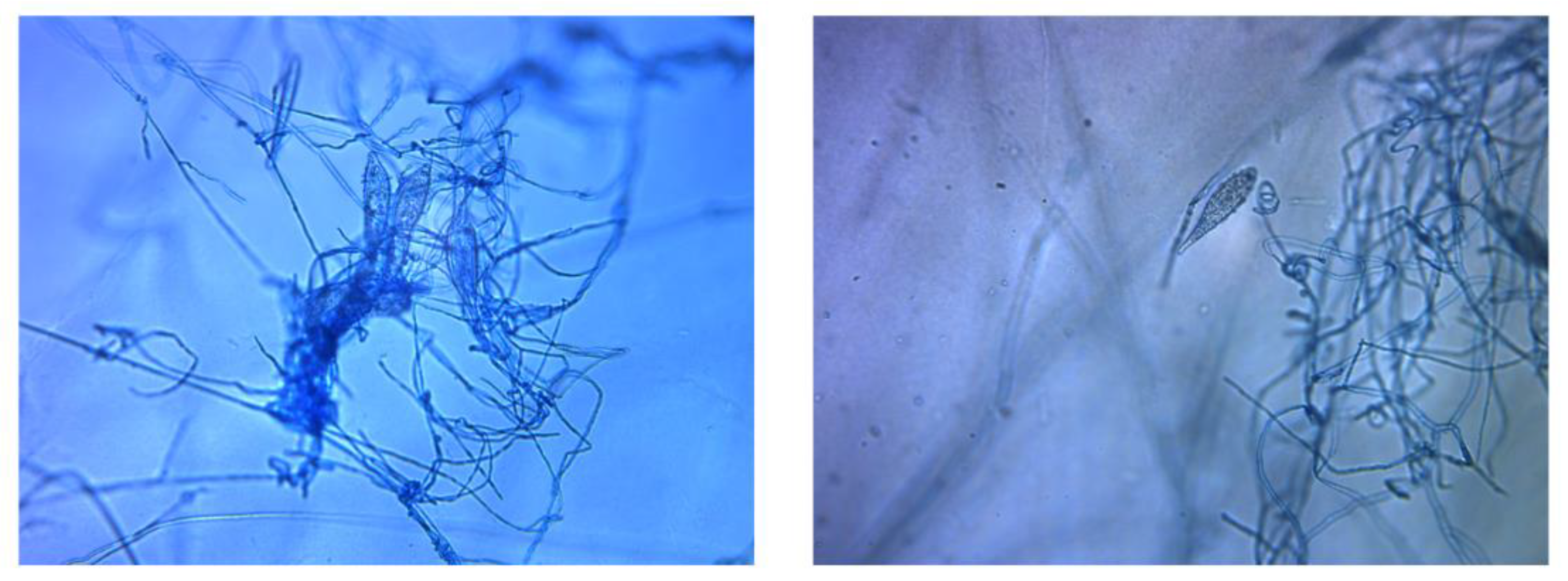 Tropicalmed 06 00009 g004