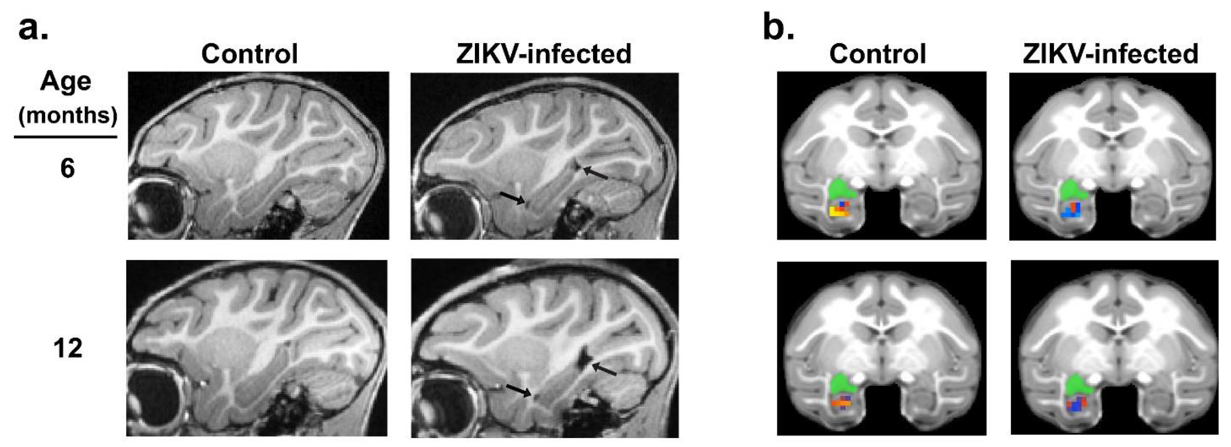 Tropicalmed 06 00010 g002 Tropicalmed 06 00010 g002