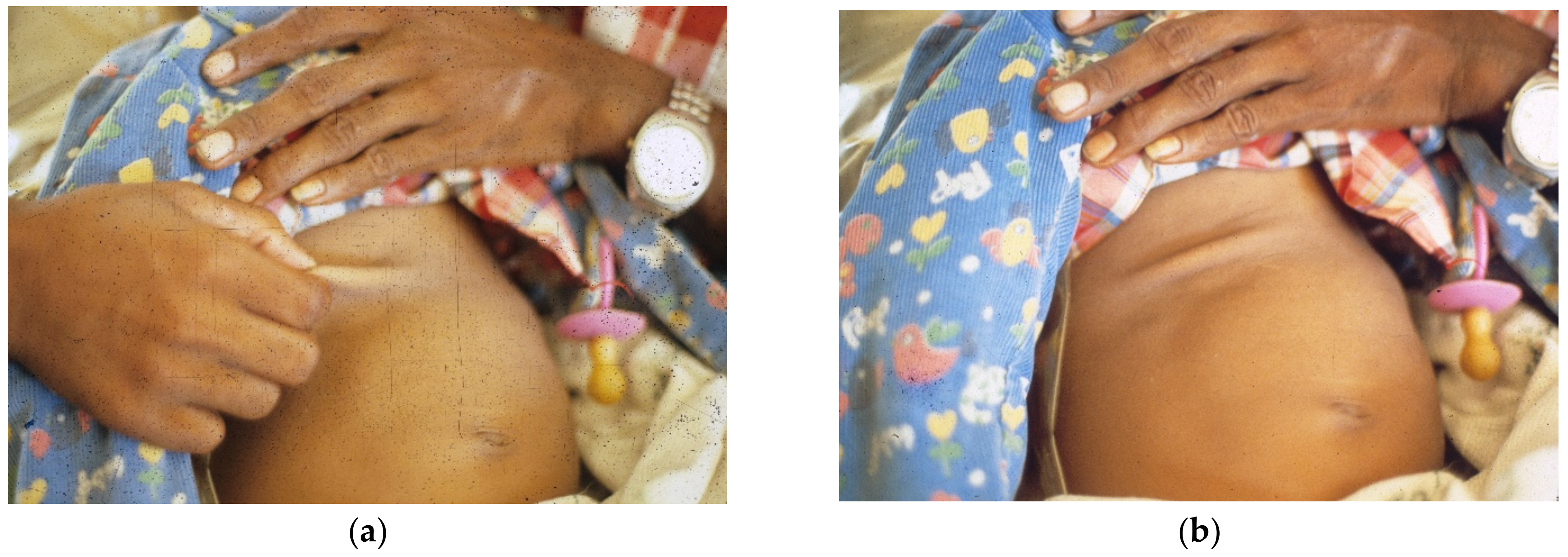 Tropicalmed 06 00034 g002