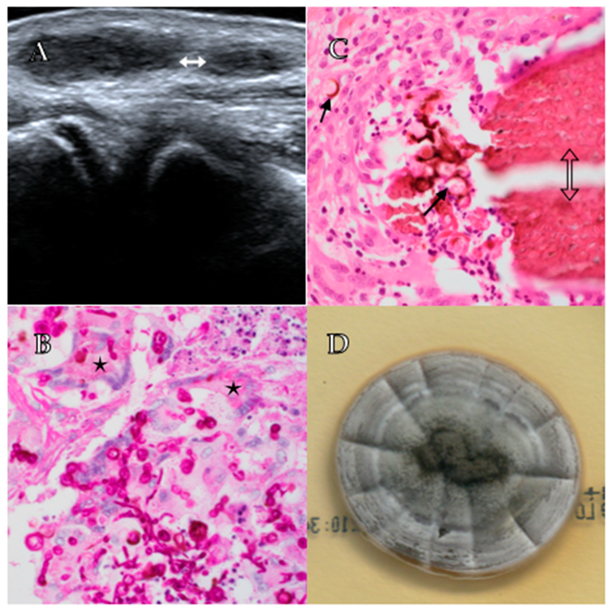 Tropicalmed 06 00144 g001