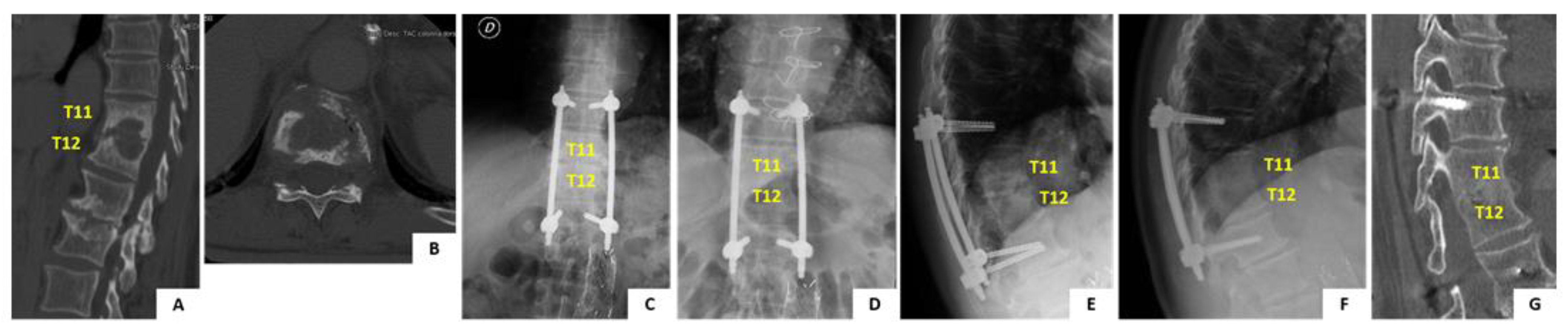 Tropicalmed 06 00159 g005 550