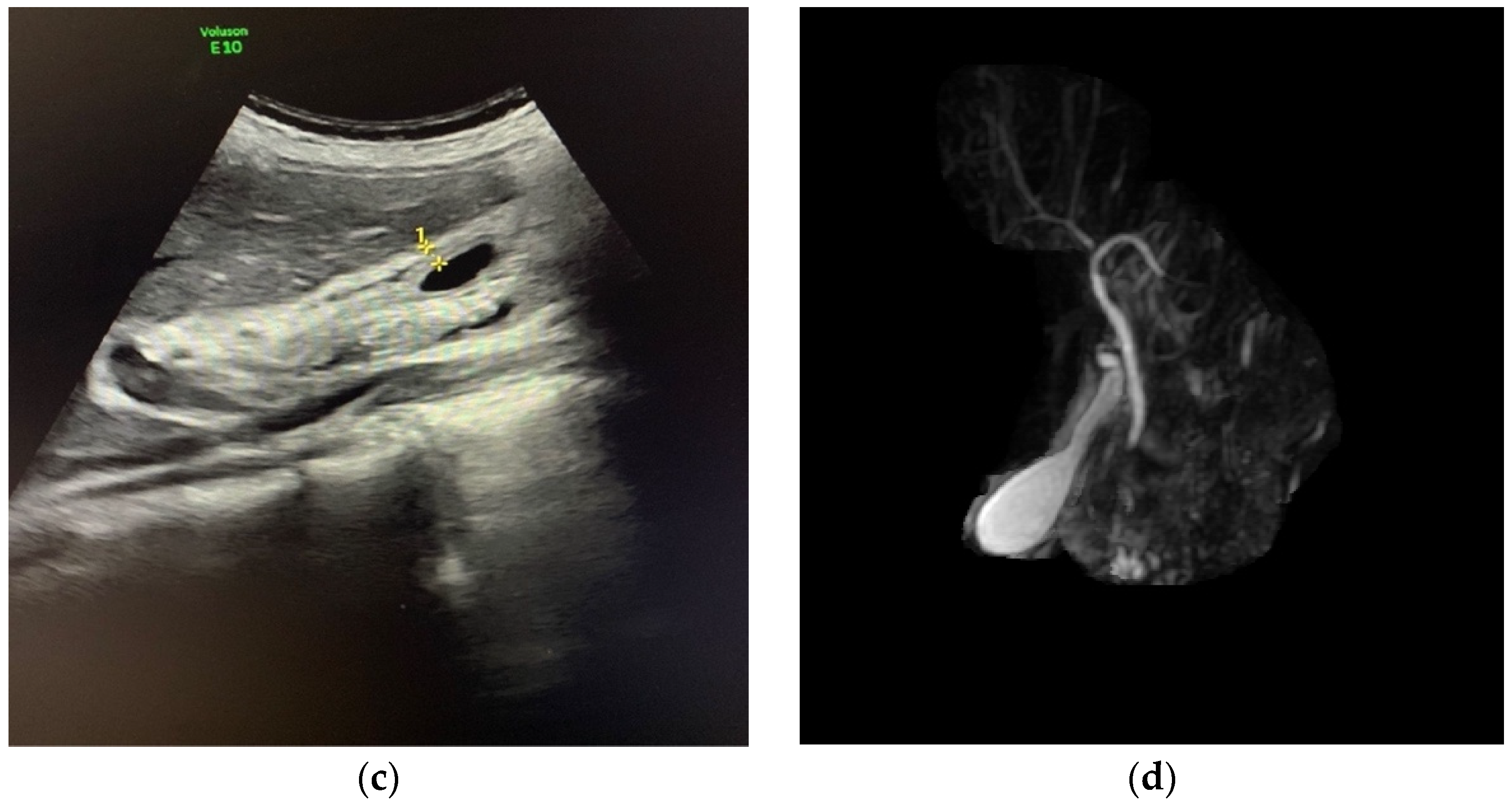 Tropicalmed 06 00208 g001b