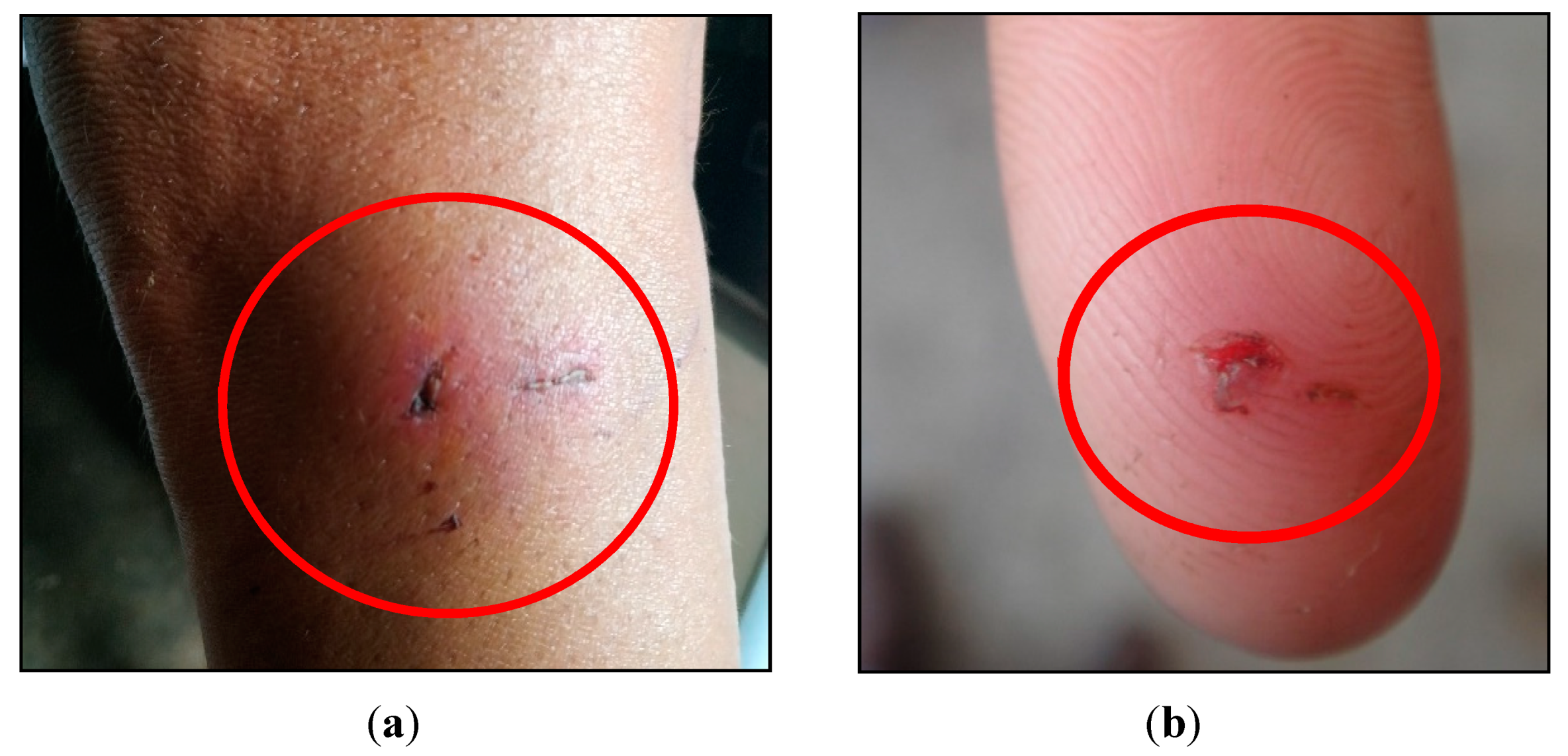 Tropicalmed 06 00209 g007