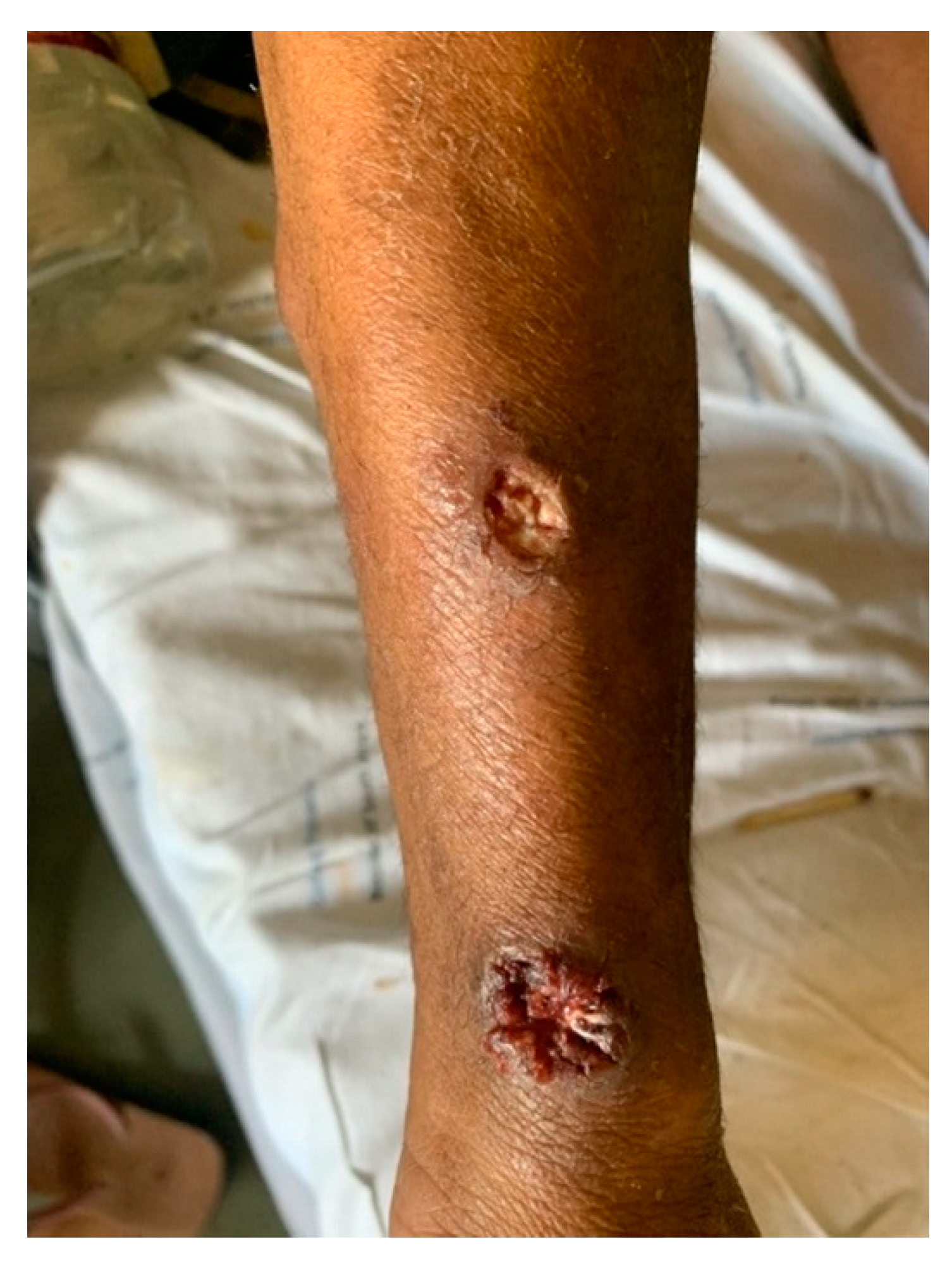 Tropicalmed 07 00024 g003 550