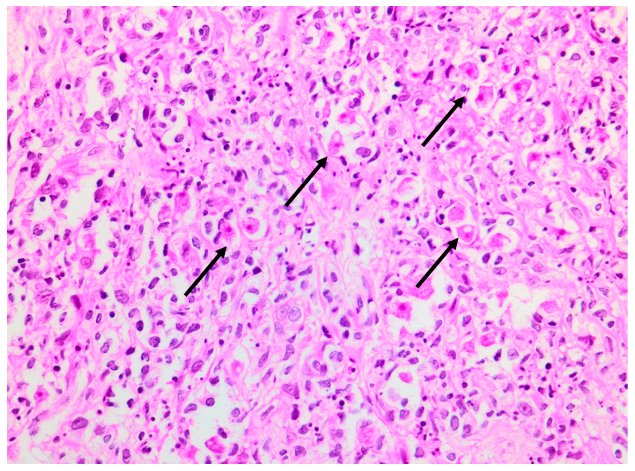 Tropicalmed 07 00024 g005 550