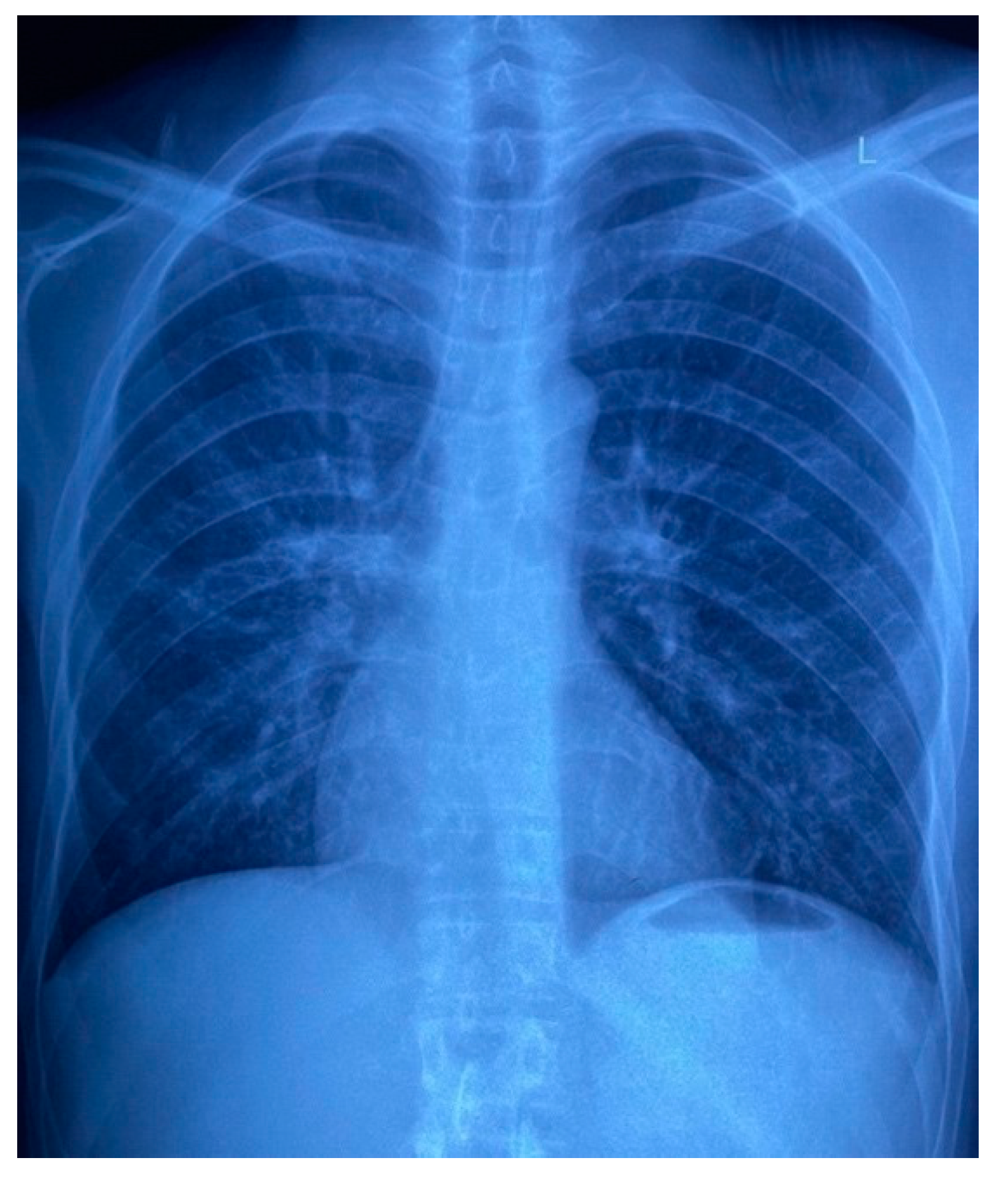 Tropicalmed 07 00024 g007 550