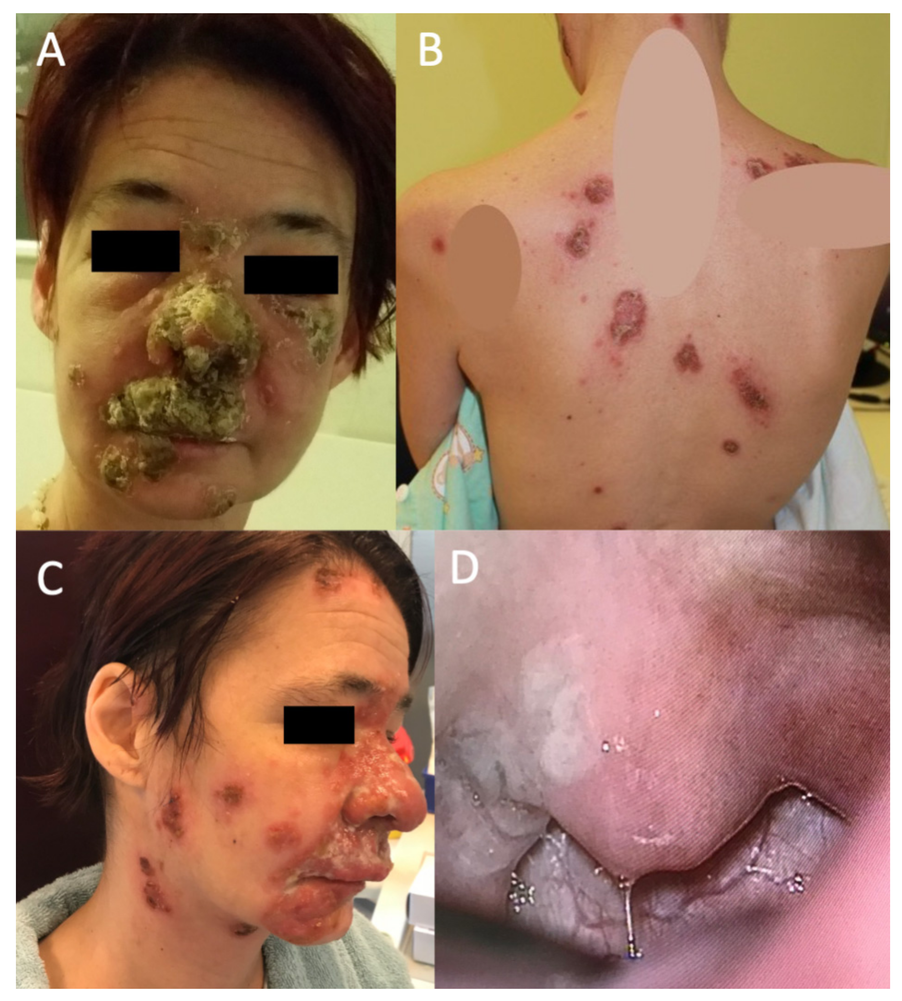 Tropicalmed 07 00047 g001 550