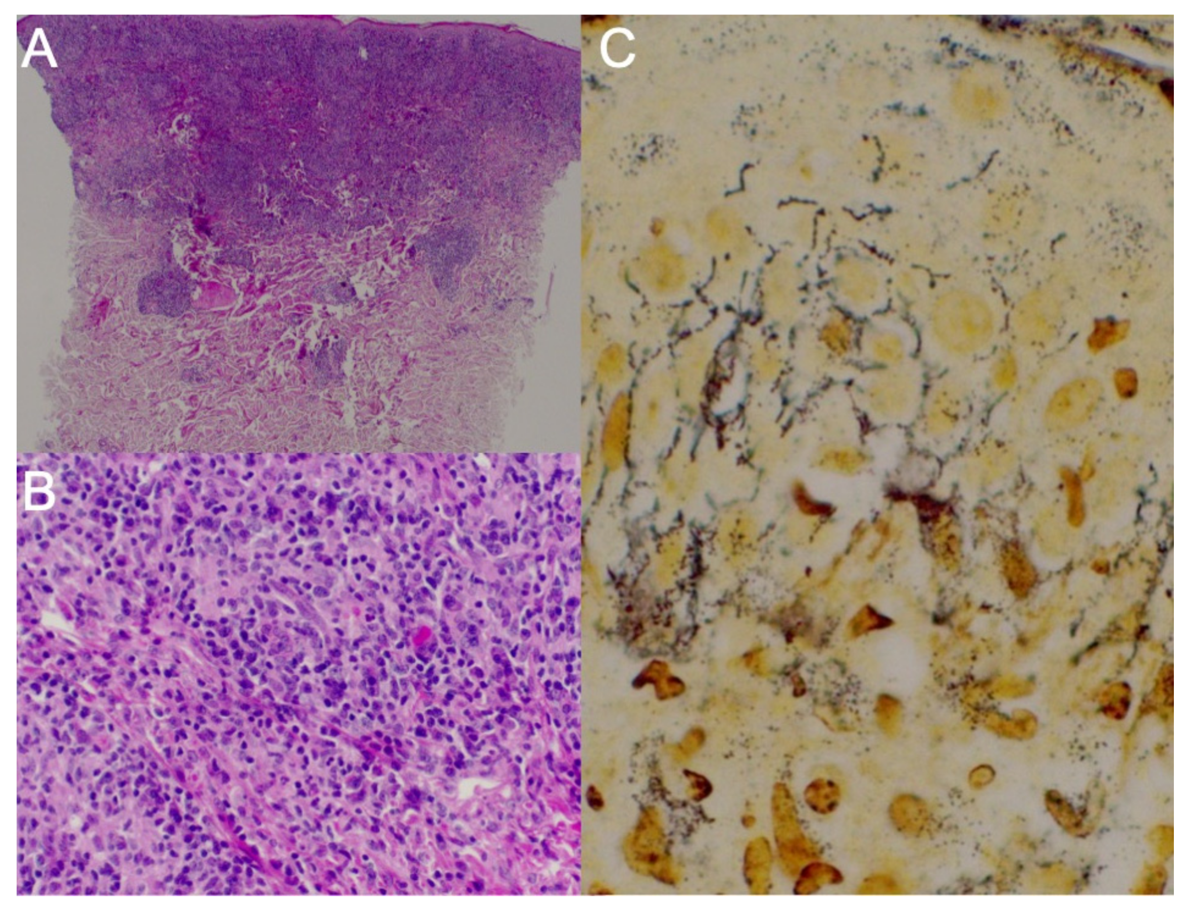 Tropicalmed 07 00047 g002 550