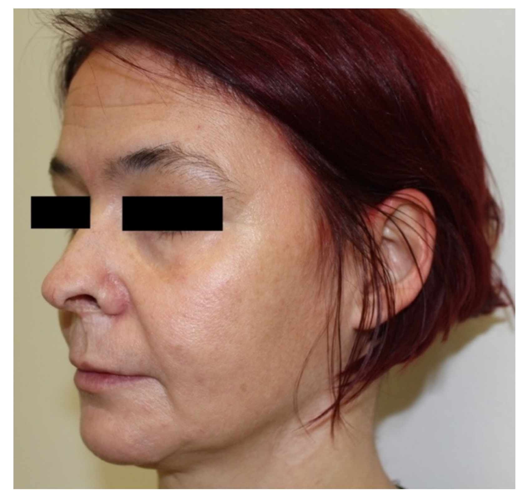 Tropicalmed 07 00047 g003 550