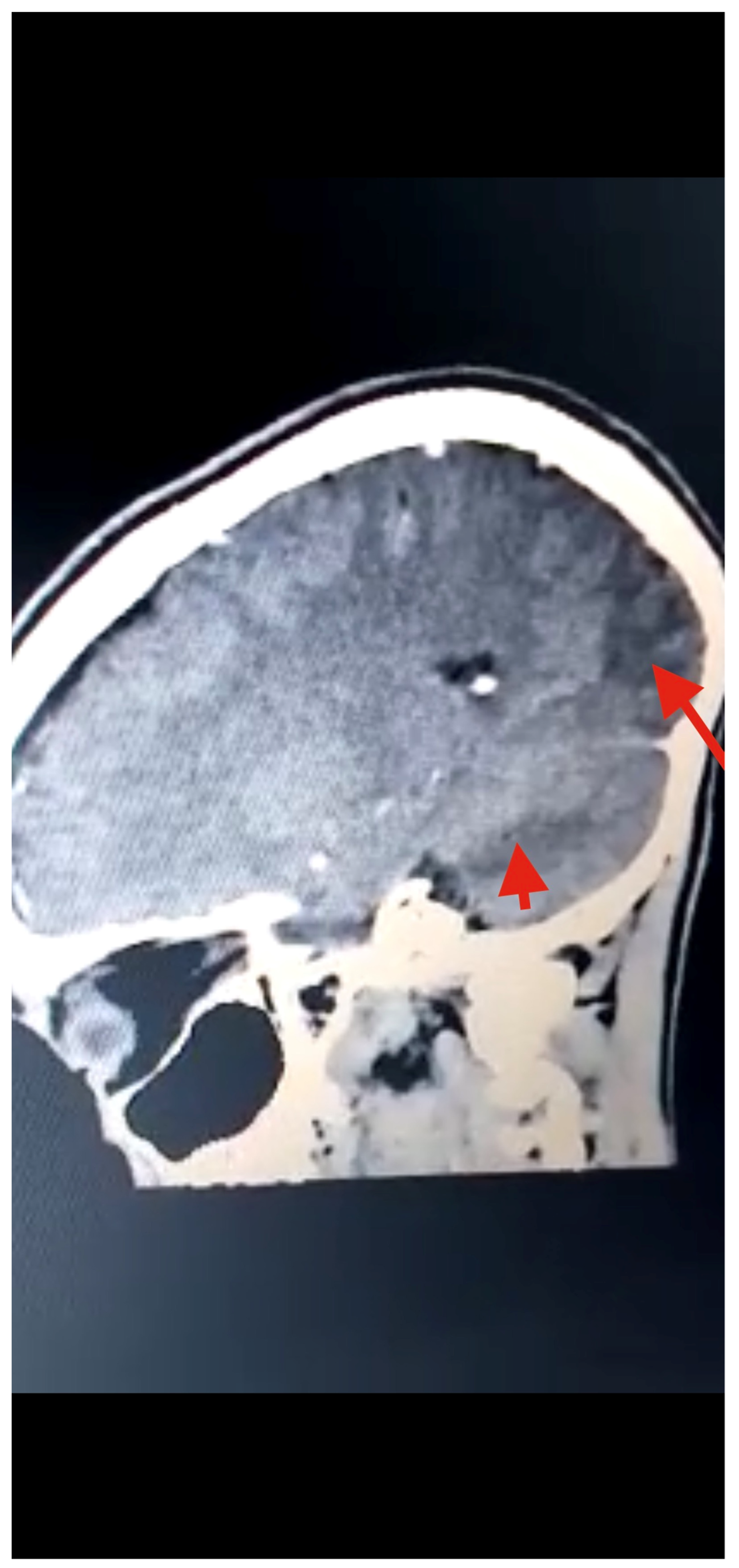 Tropicalmed 07 00096 g003 550