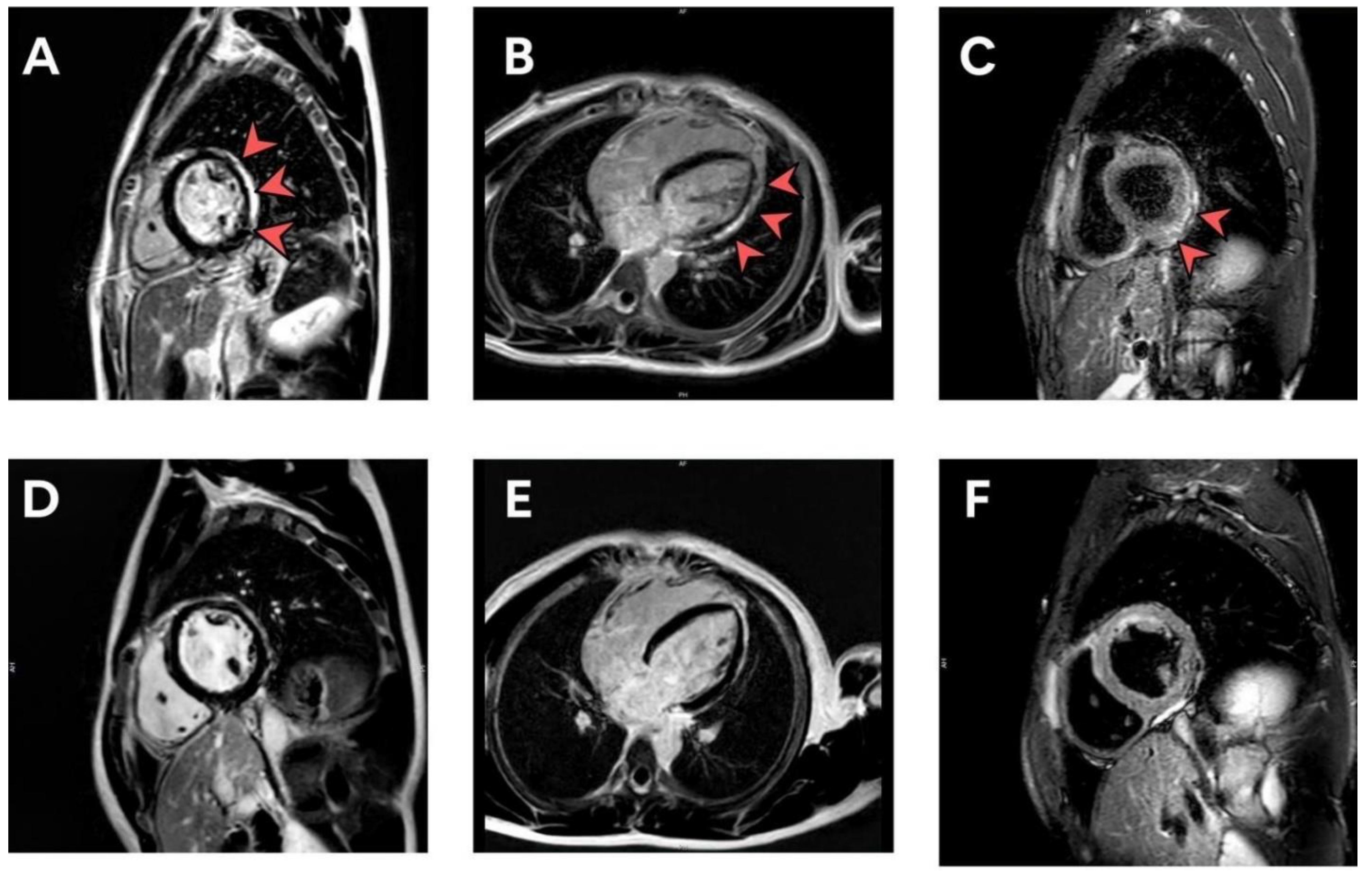 Tropicalmed 07 00196 g002 550