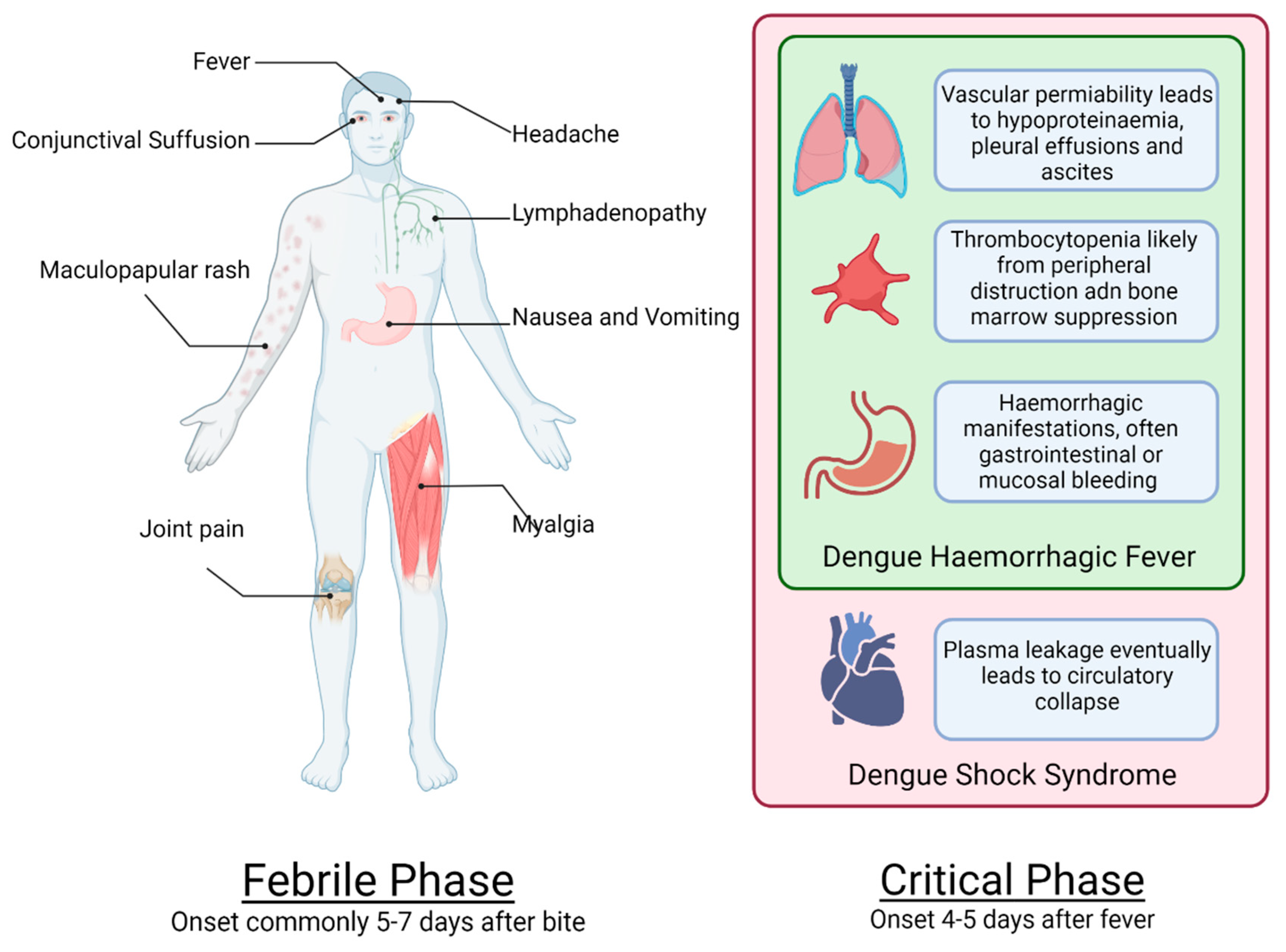 Dengue Shock Syndrome dengue-shock-syndrome