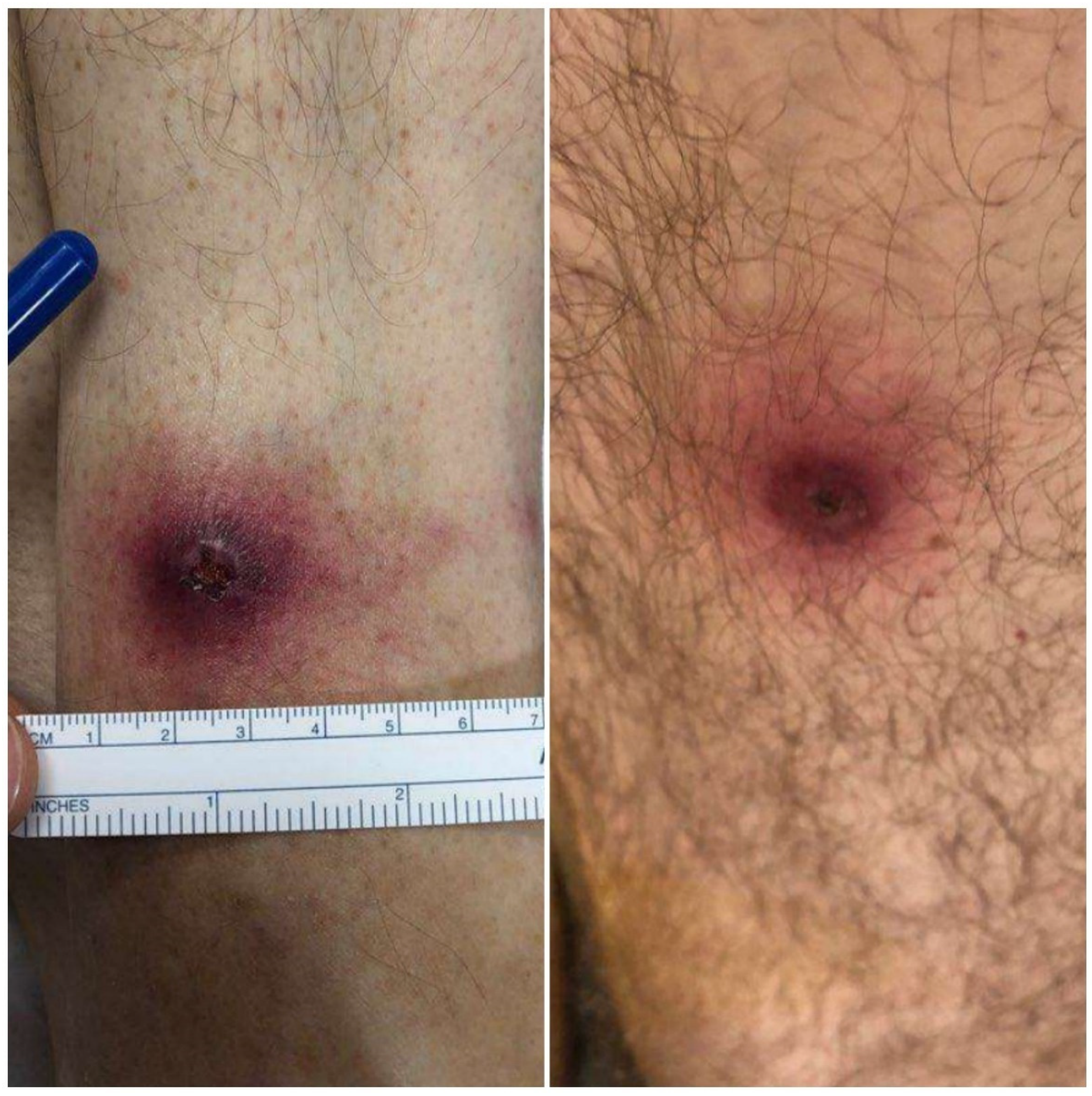 Tropicalmed 07 00220 g001