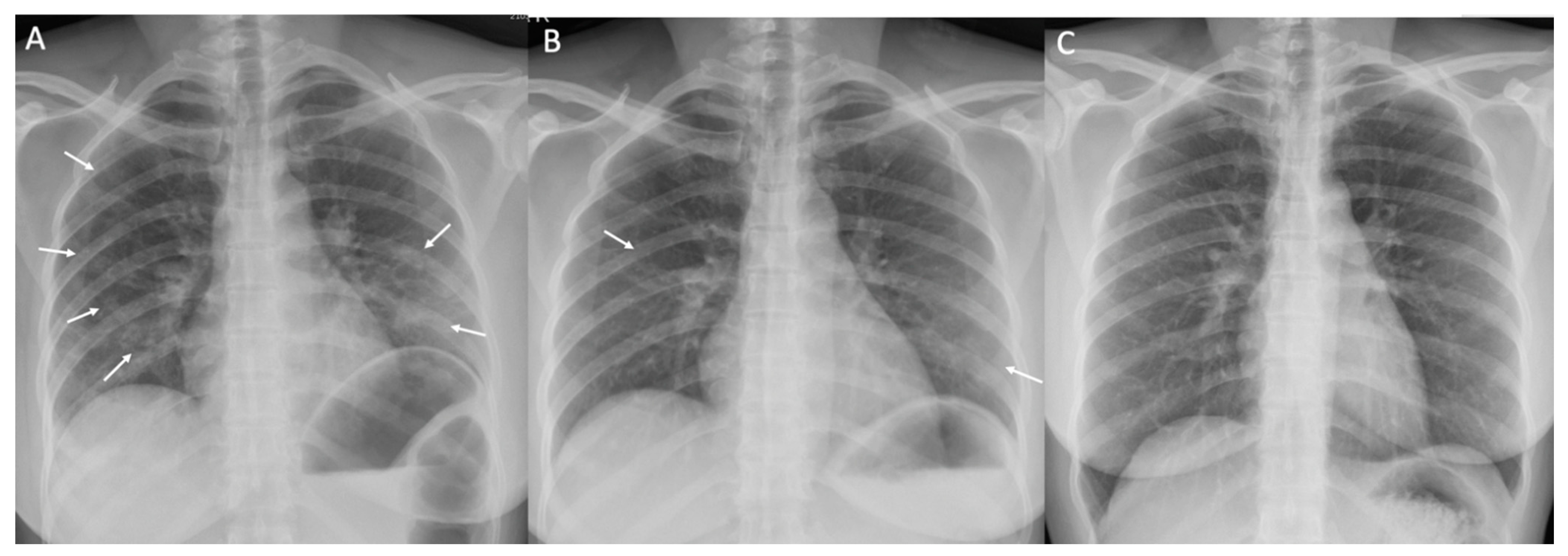 Tropicalmed 07 00238 g002 550