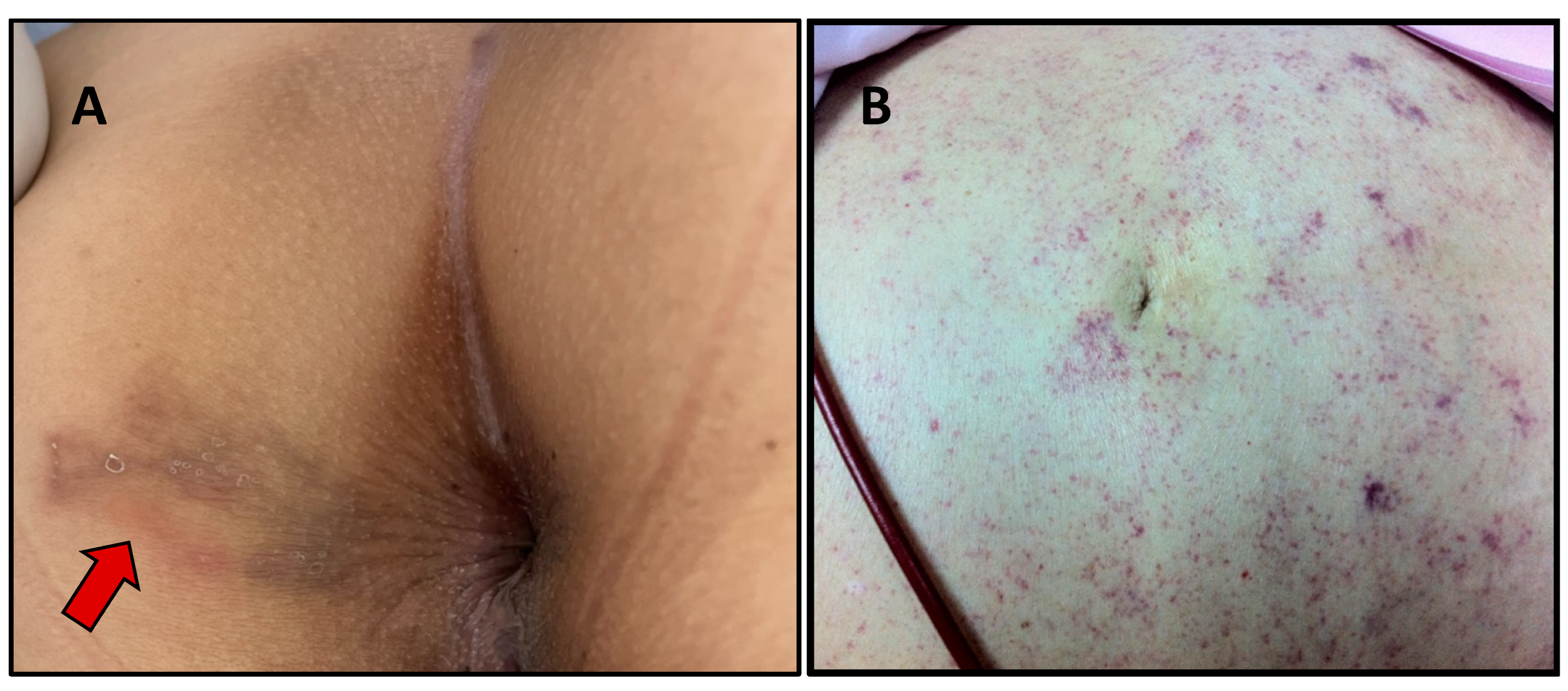 Tropicalmed 07 00310 g003 Tropicalmed 07 00310 g003