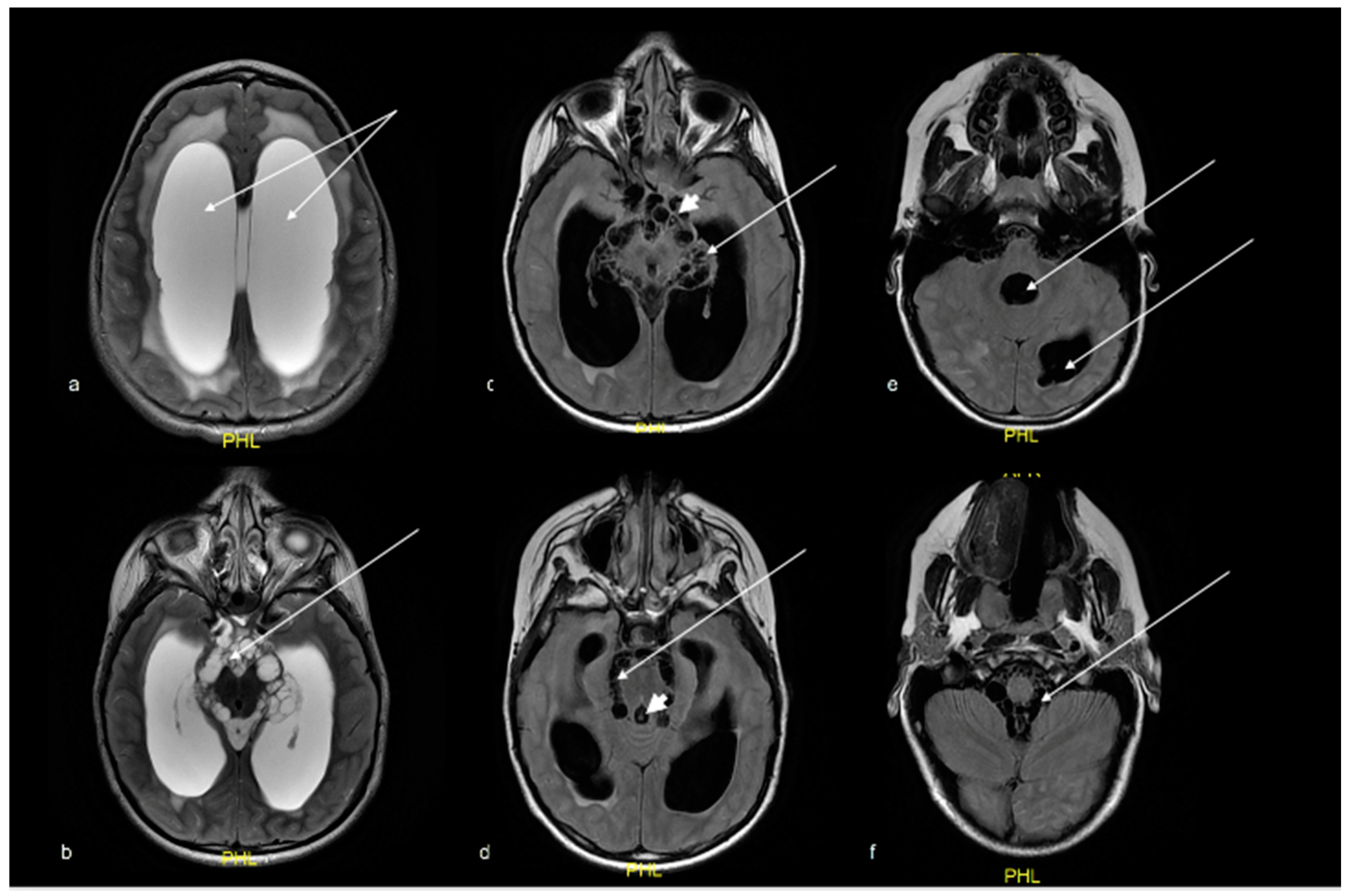 Tropicalmed 07 00405 g001 Tropicalmed 07 00405 g001