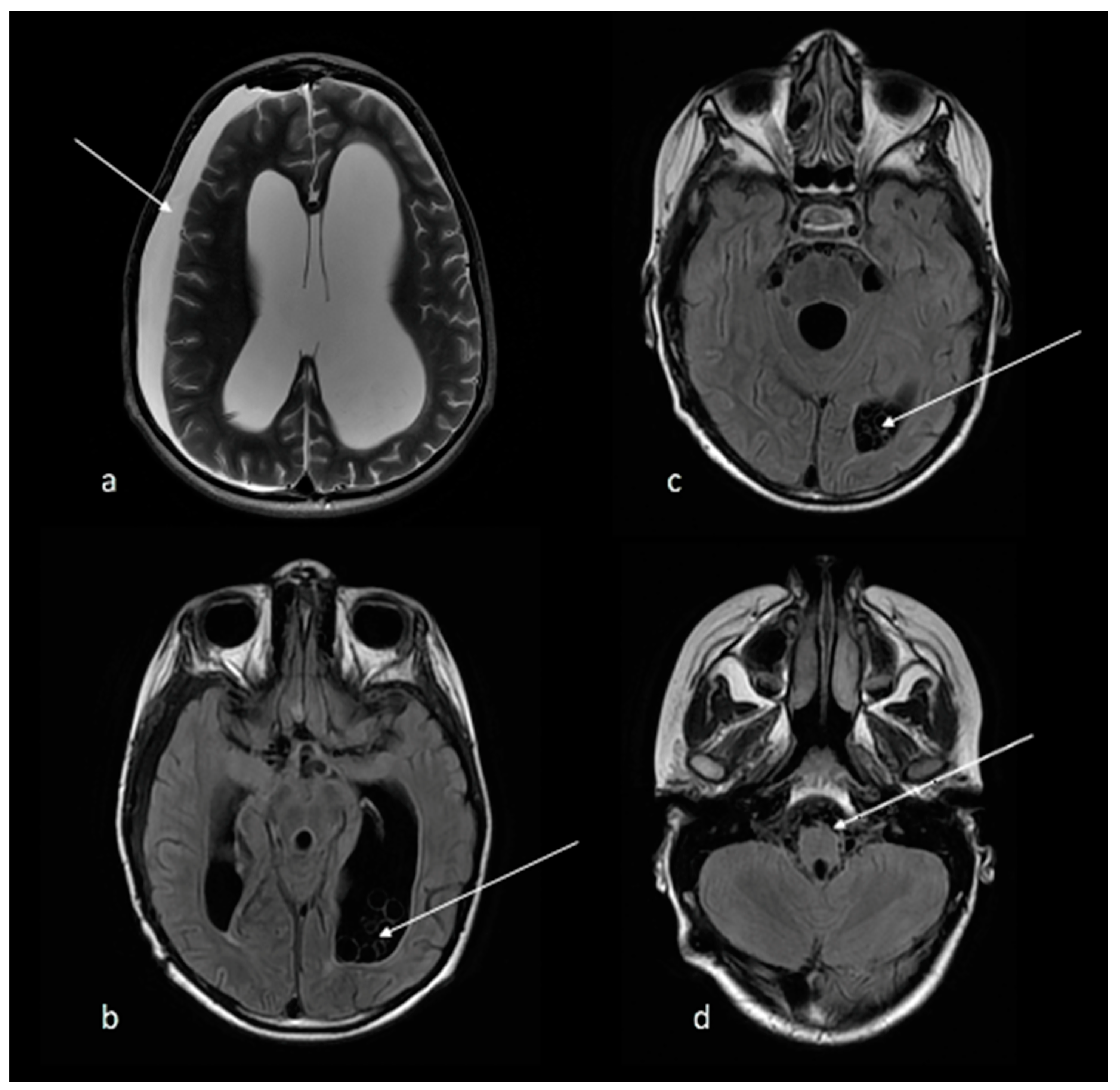 Tropicalmed 07 00405 g004 Tropicalmed 07 00405 g004