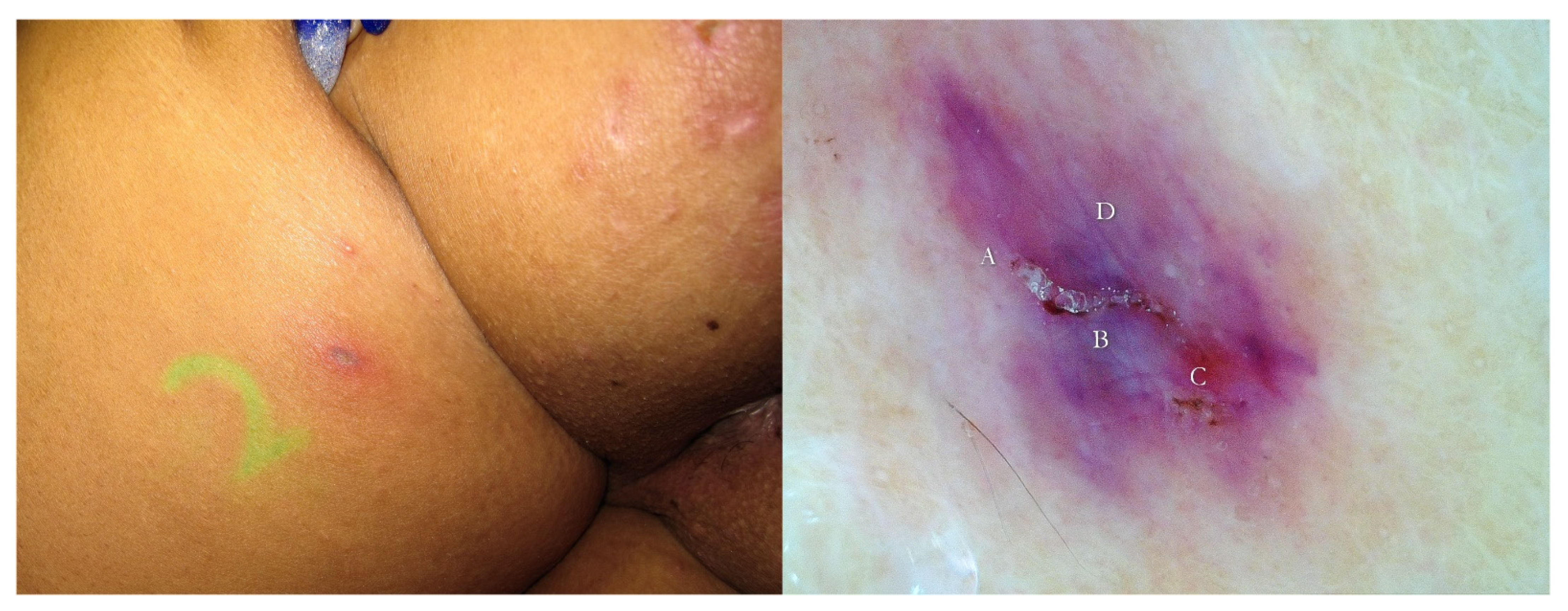 Tropicalmed 07 00422 g003