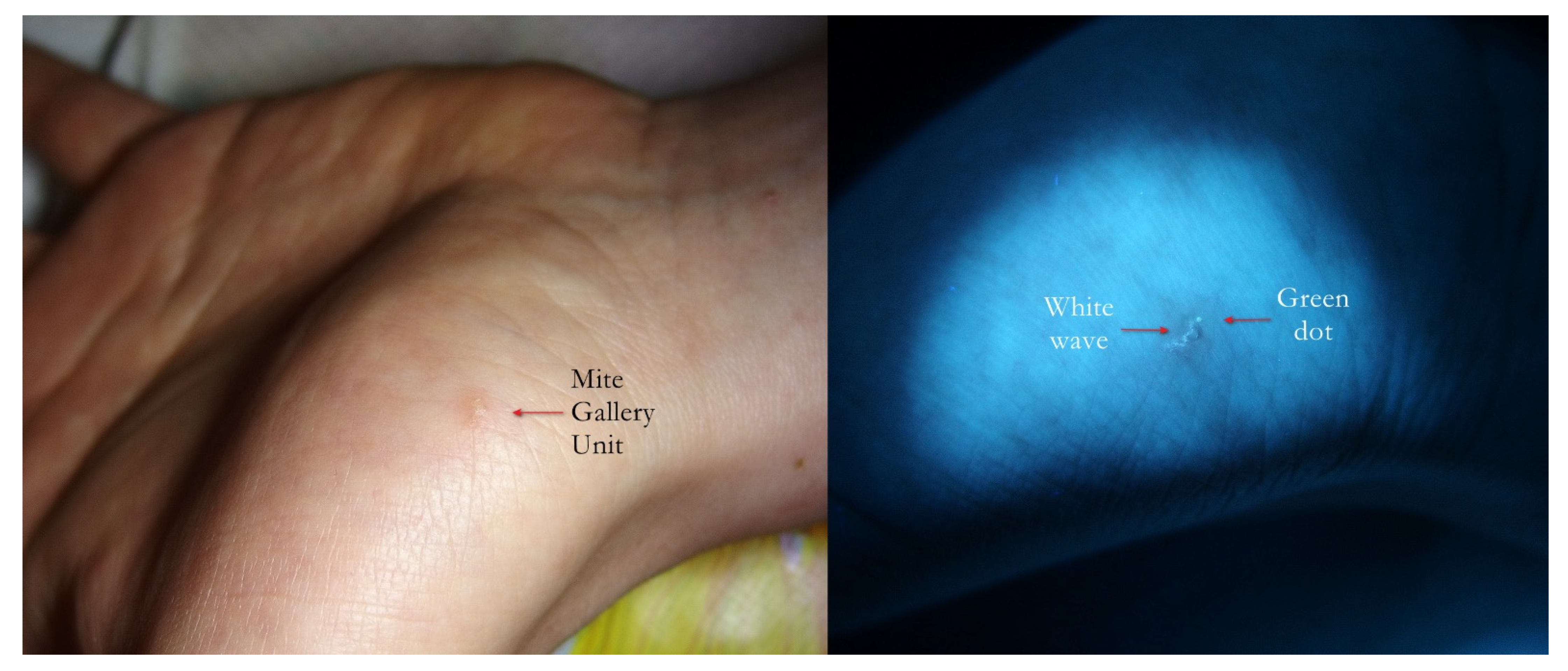 Tropicalmed 07 00422 g011